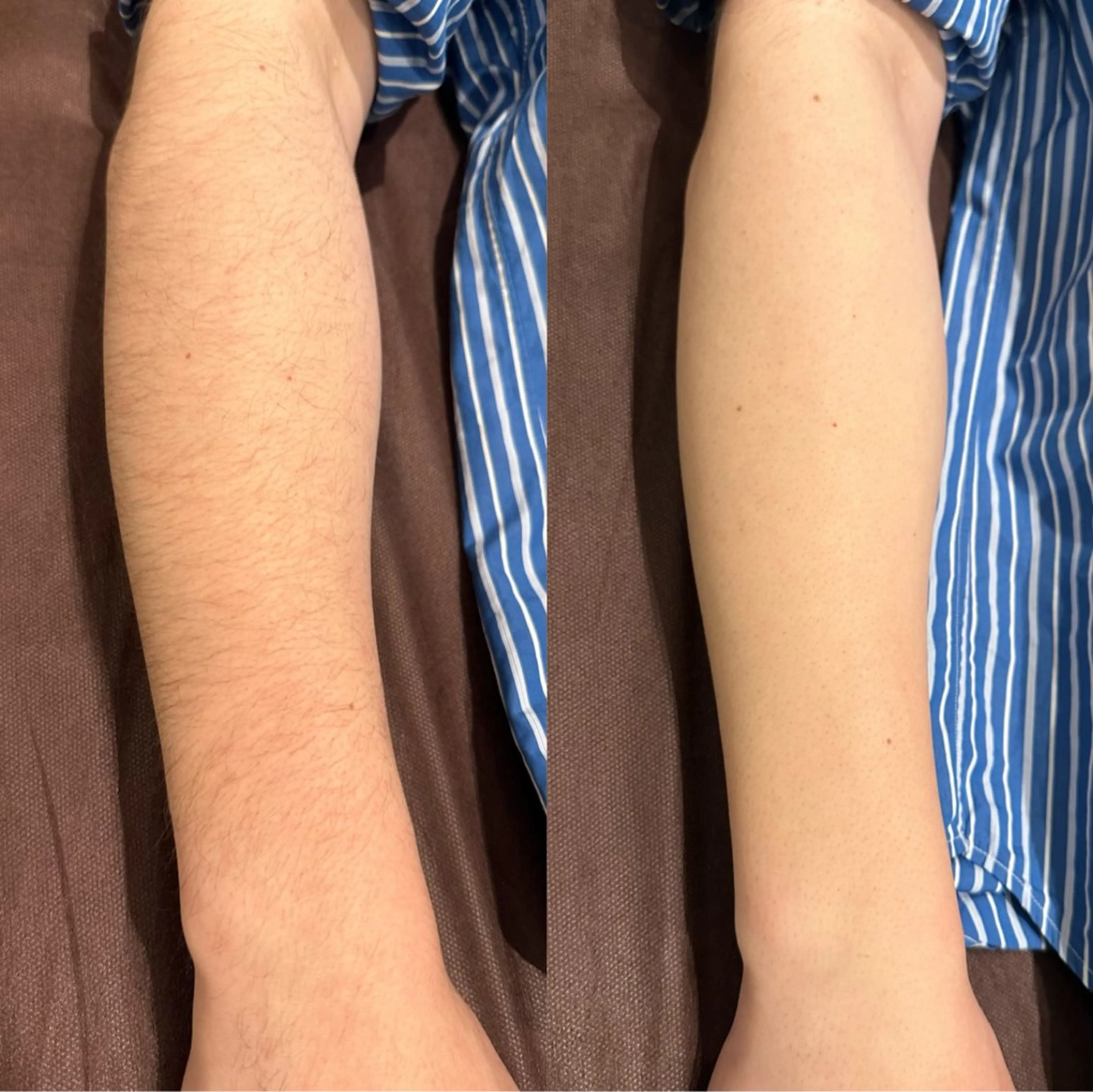 脱毛 脱毛サロン Exsior.博多店の眉毛・アイブロウイメージ