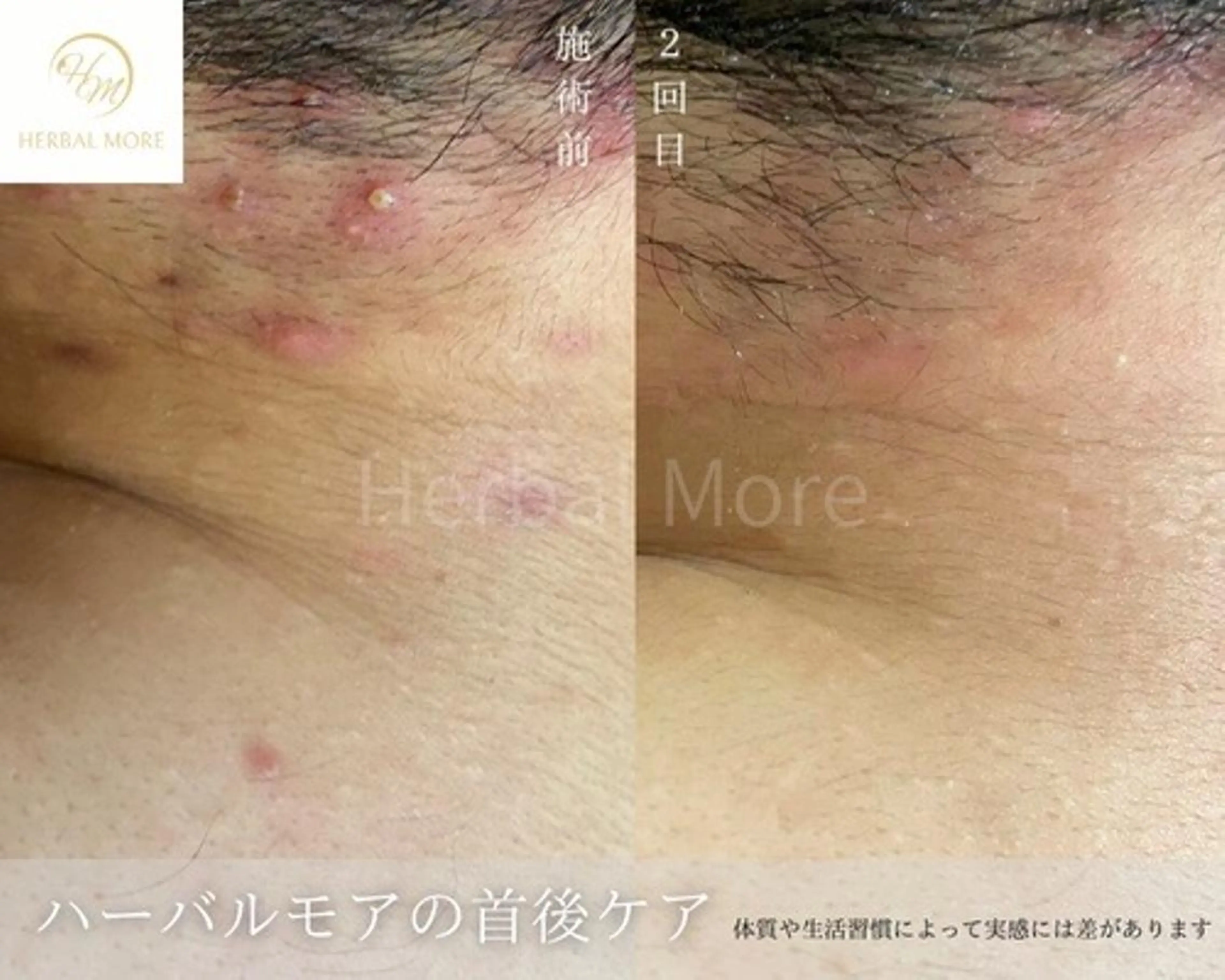 脱毛・眉毛・フェイス サロンN久留米店の眉毛・アイブロウイメージ