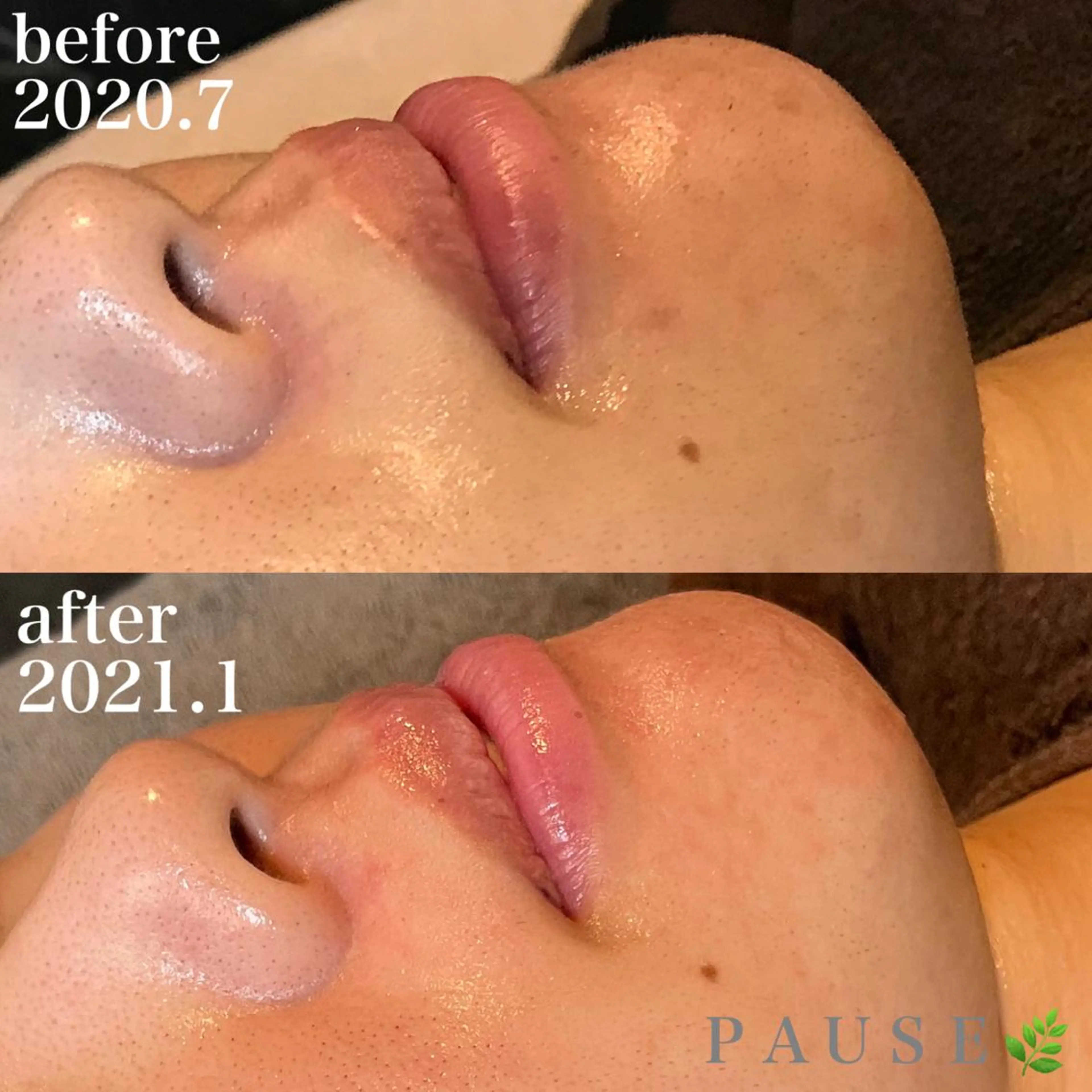 エステ 浜野 恵美のエステ・リラクイメージ