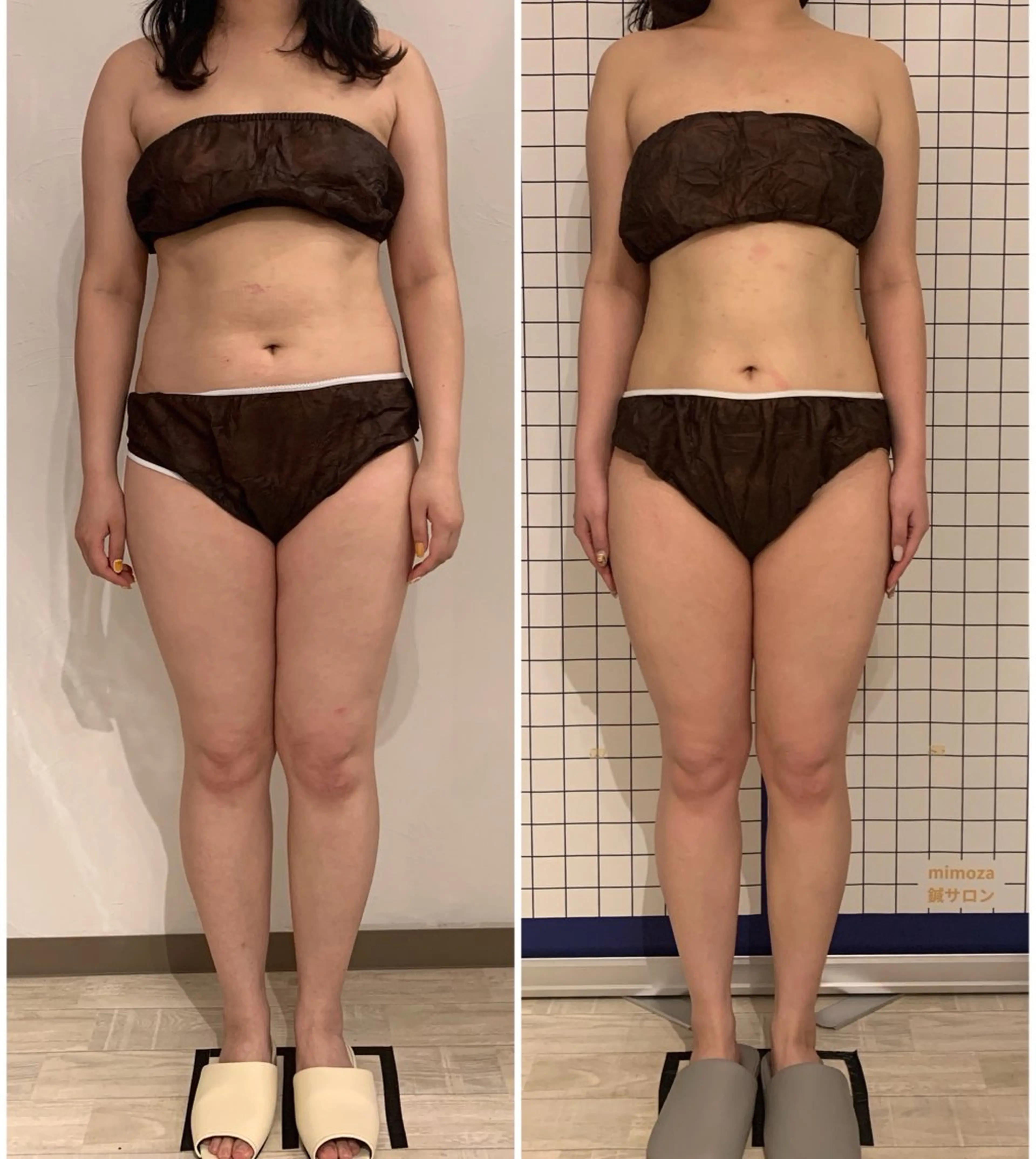 エステ リラク リンパマッサージ mimozaのエステ・リラクイメージ