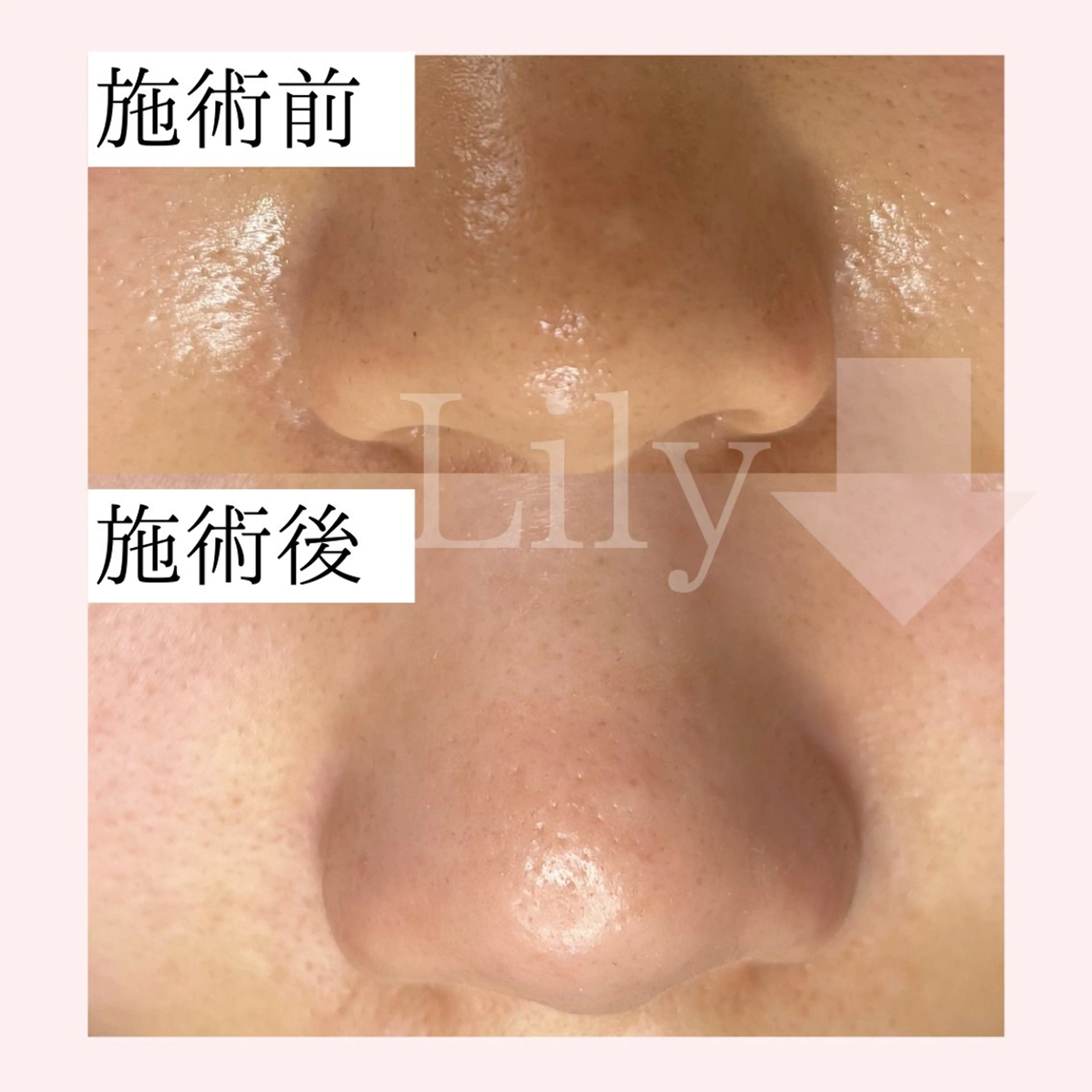 トータルビューティー サロンLilyのエステ・リラクイメージ