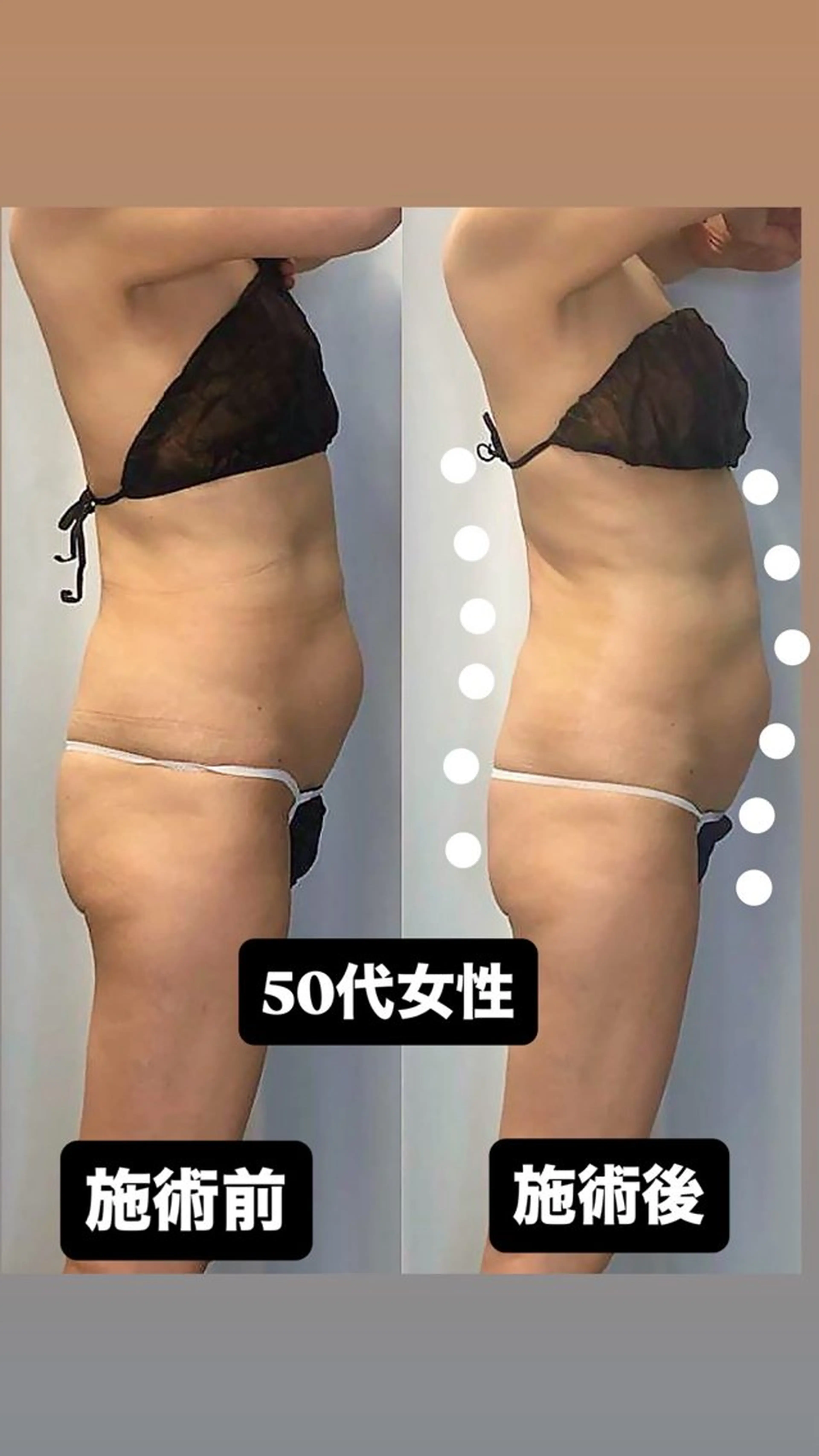 エステ 美容整体・塗る漢方・フェイシャルRechica所属・痩身・脱毛・肌管理 Rechica心斎橋のエステ・リラクイメージ