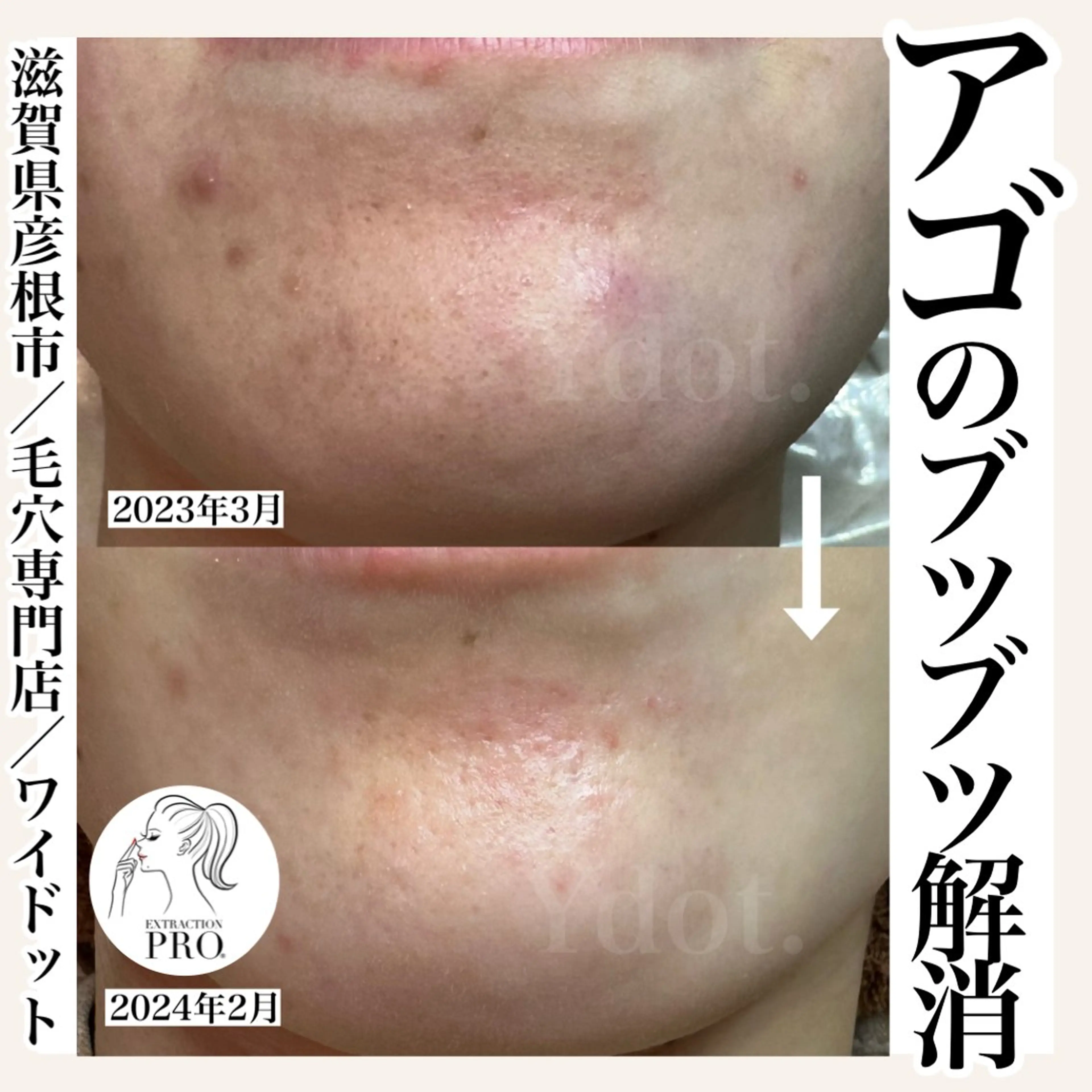 エステ Ydot. 池内 友架のエステ・リラクイメージ