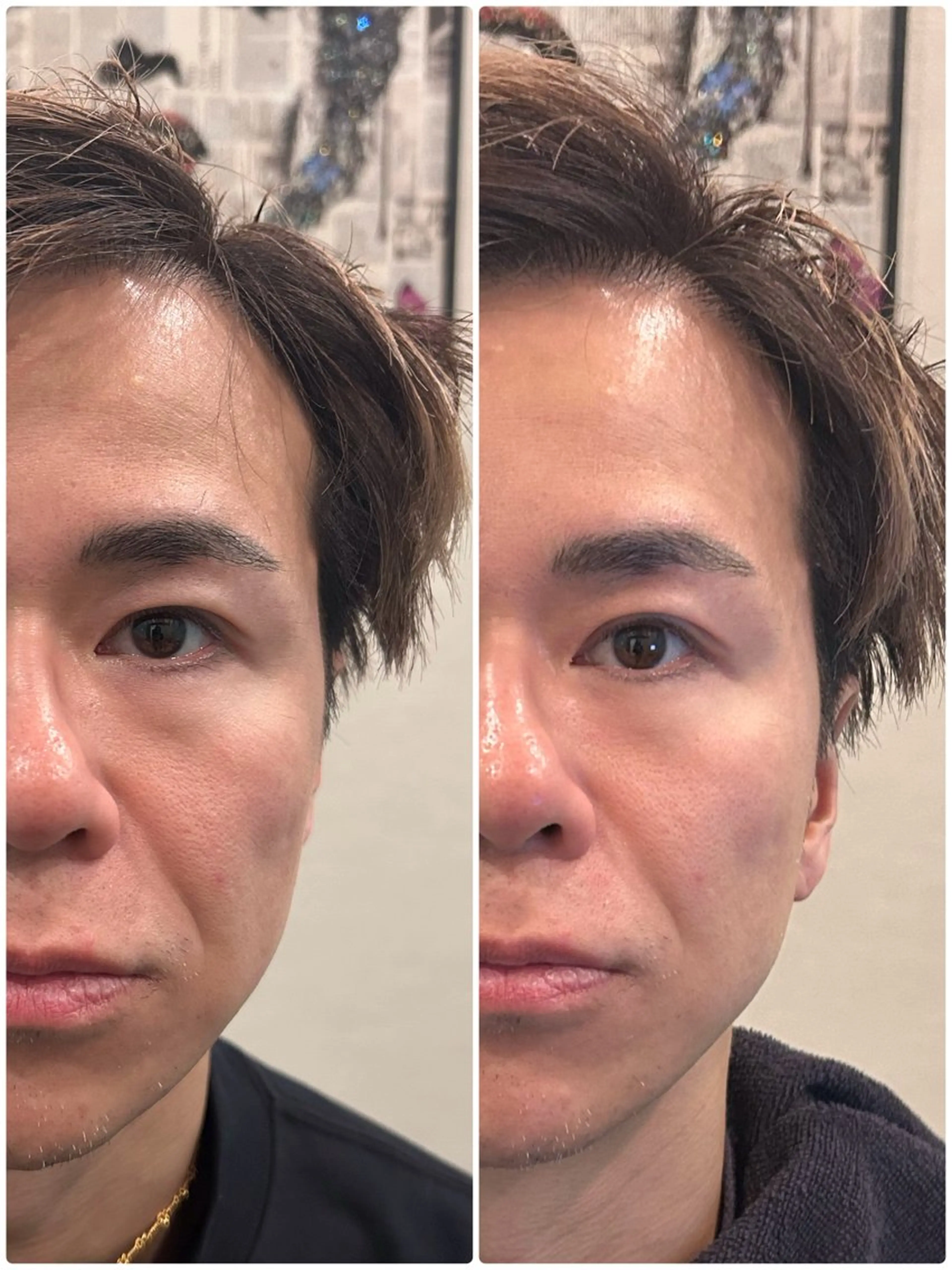 光＋リフトケア美容液＋美肌成分導入掲載用モニターの写真