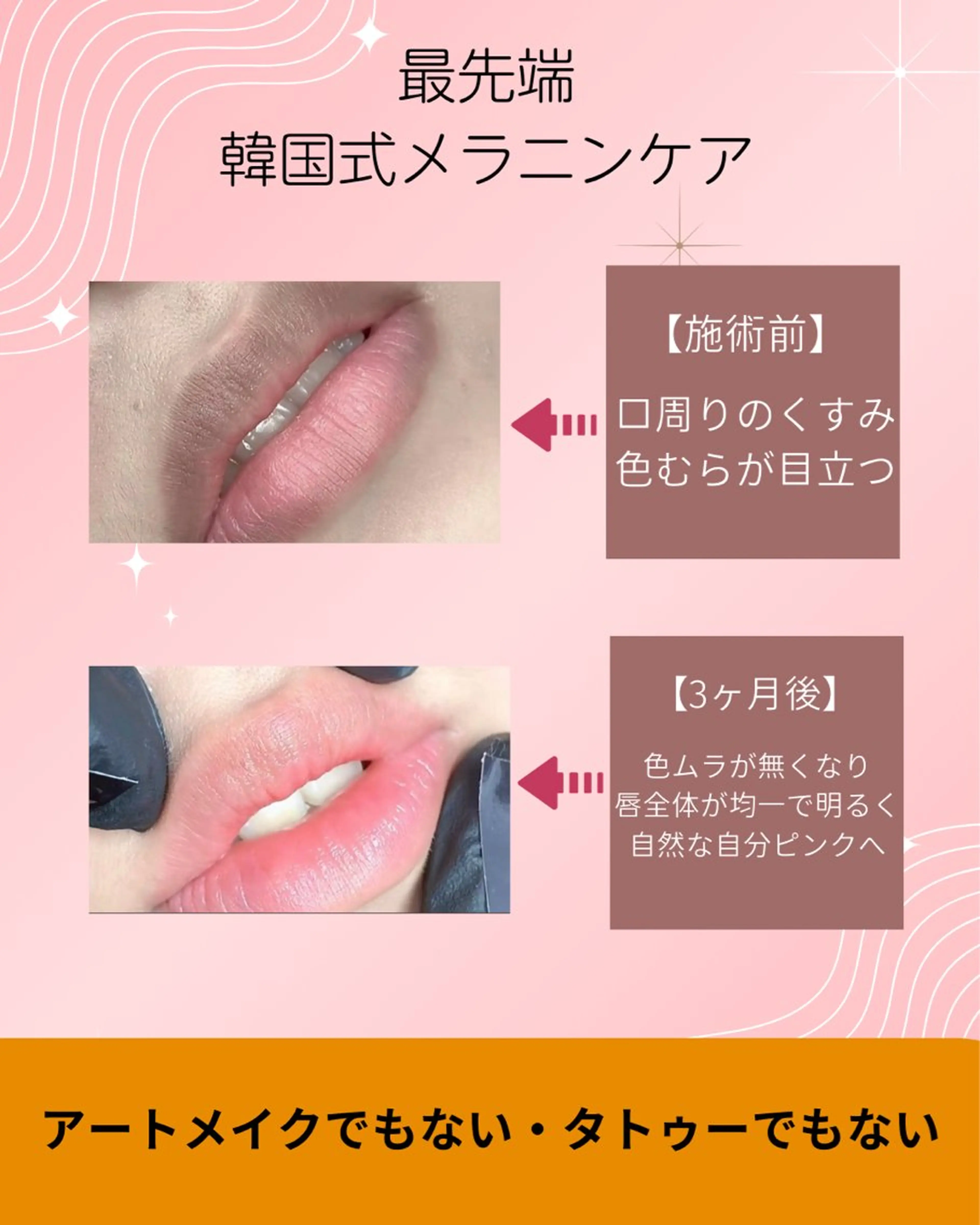 東洋美療 よつばのネイルデザイン