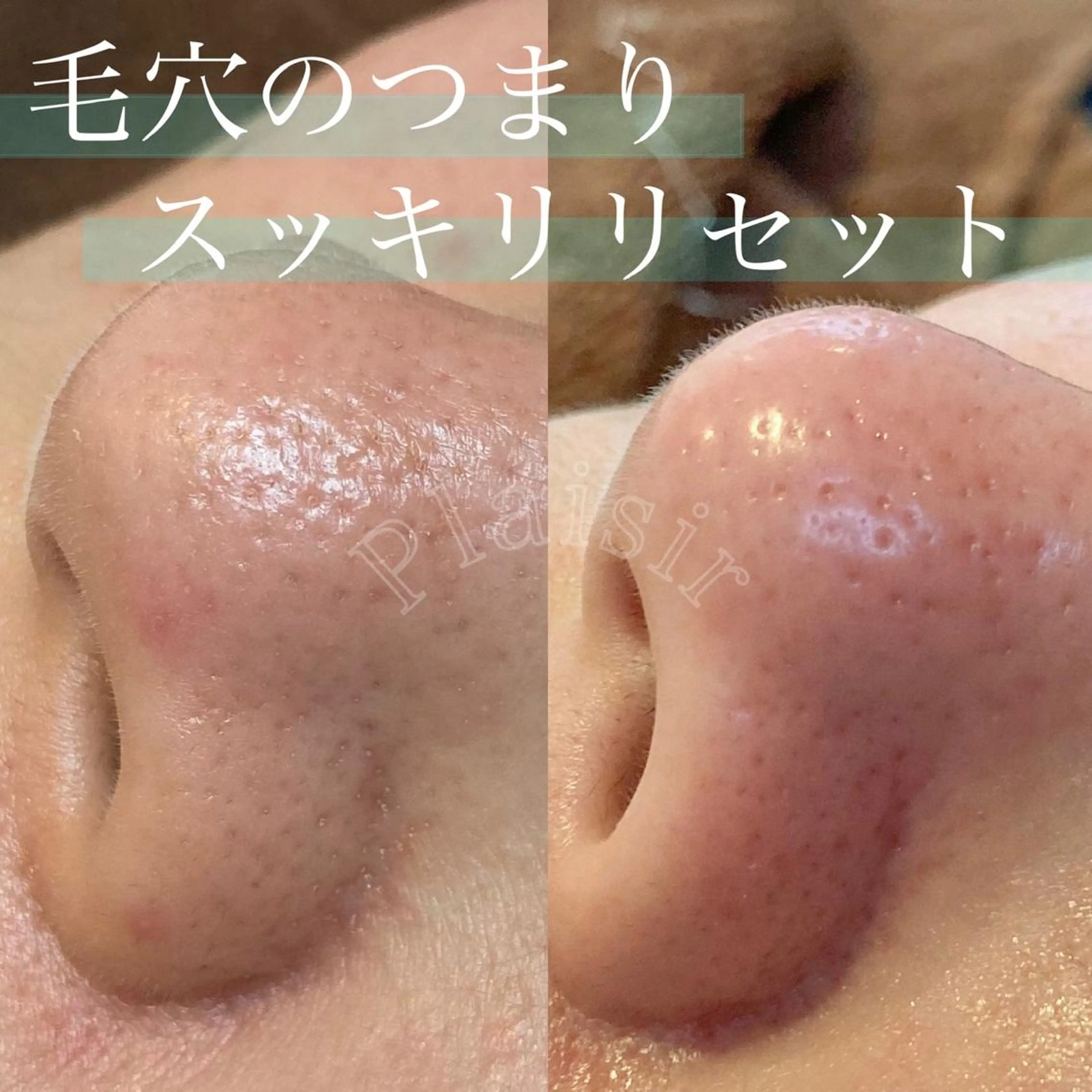 ツカハラ ミカのエステ・リラクイメージ