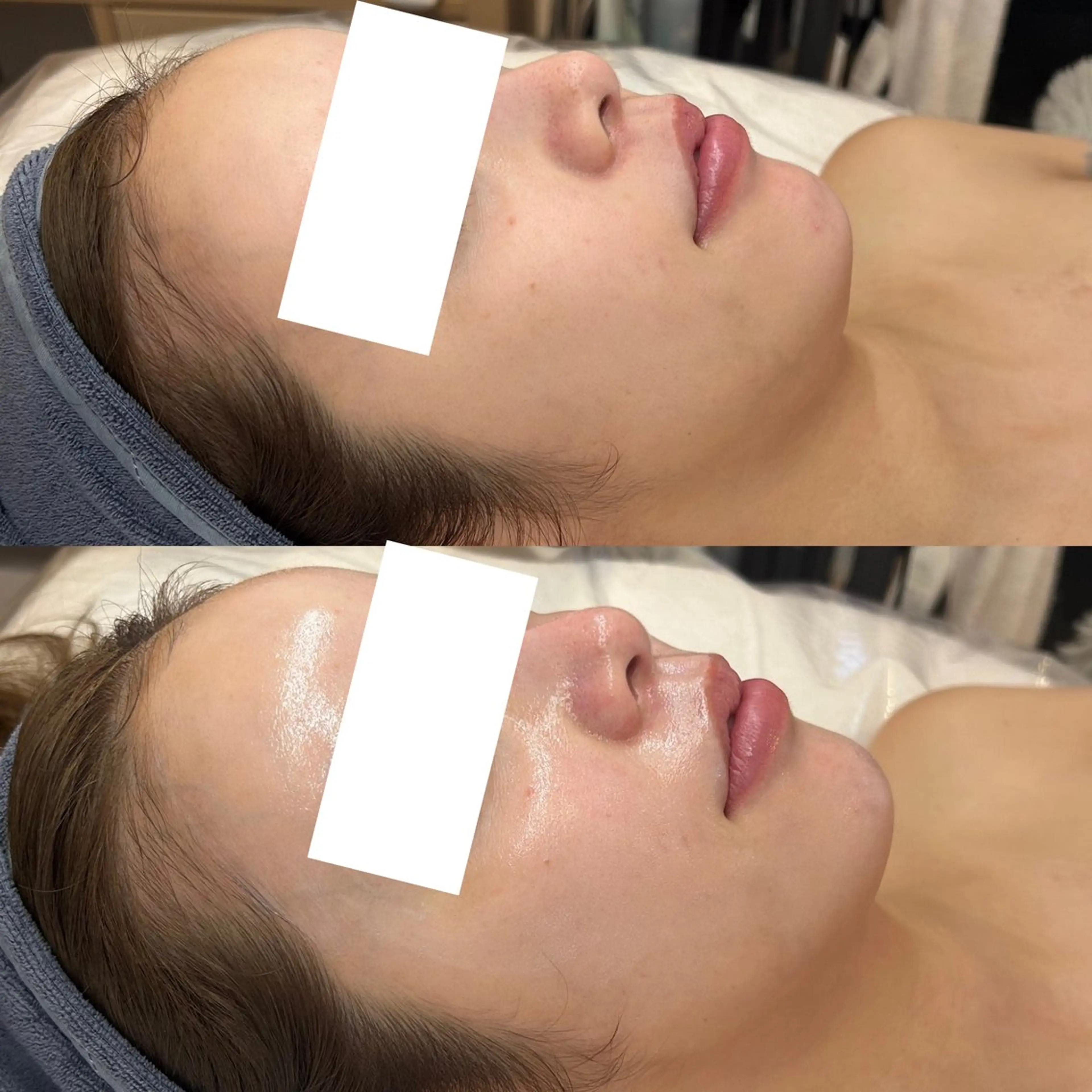 エステ 韓国🇰🇷価格 サロン_Nbibiの眉毛・アイブロウイメージ