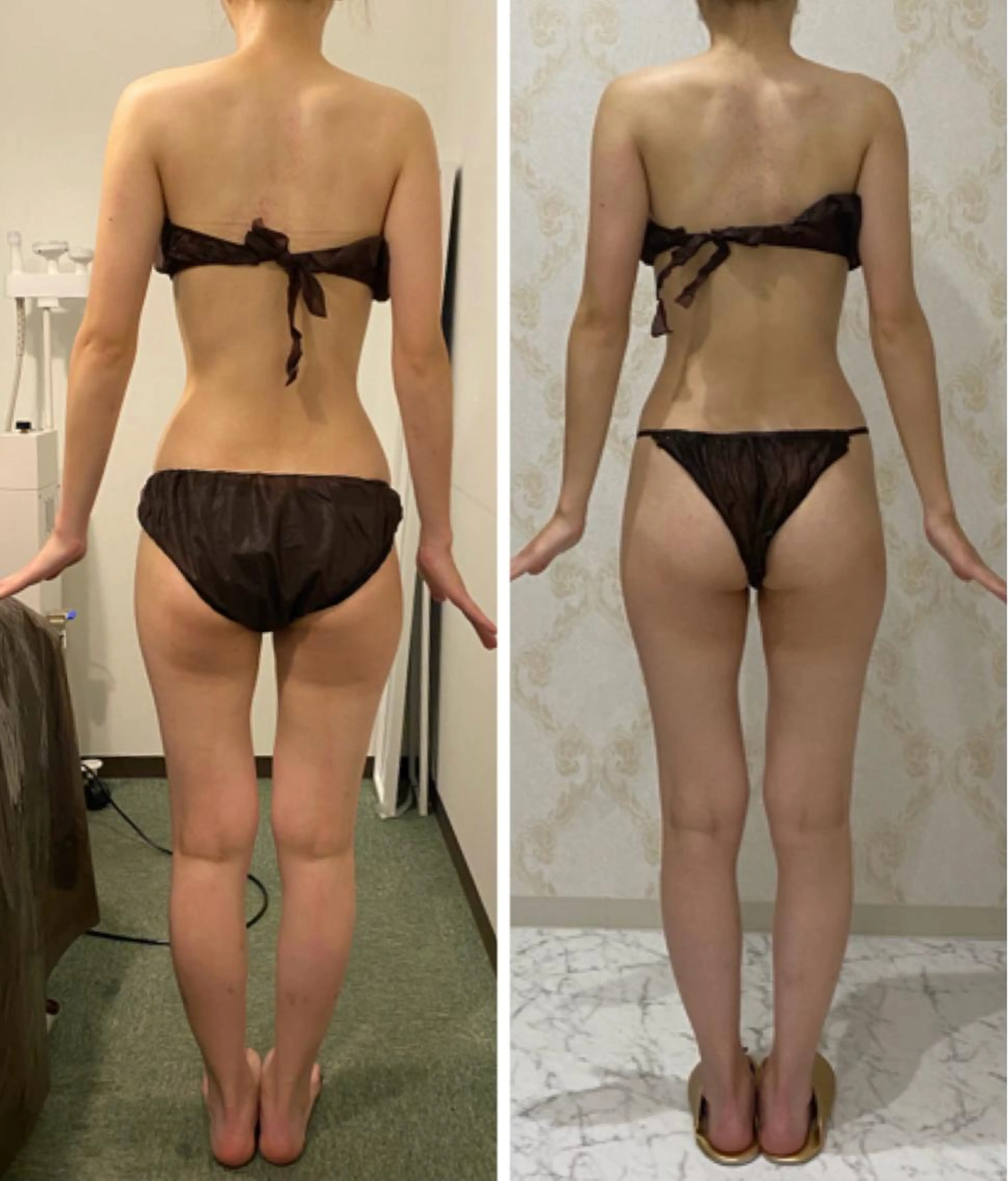 SLIMMOVE全身お試し90分の写真