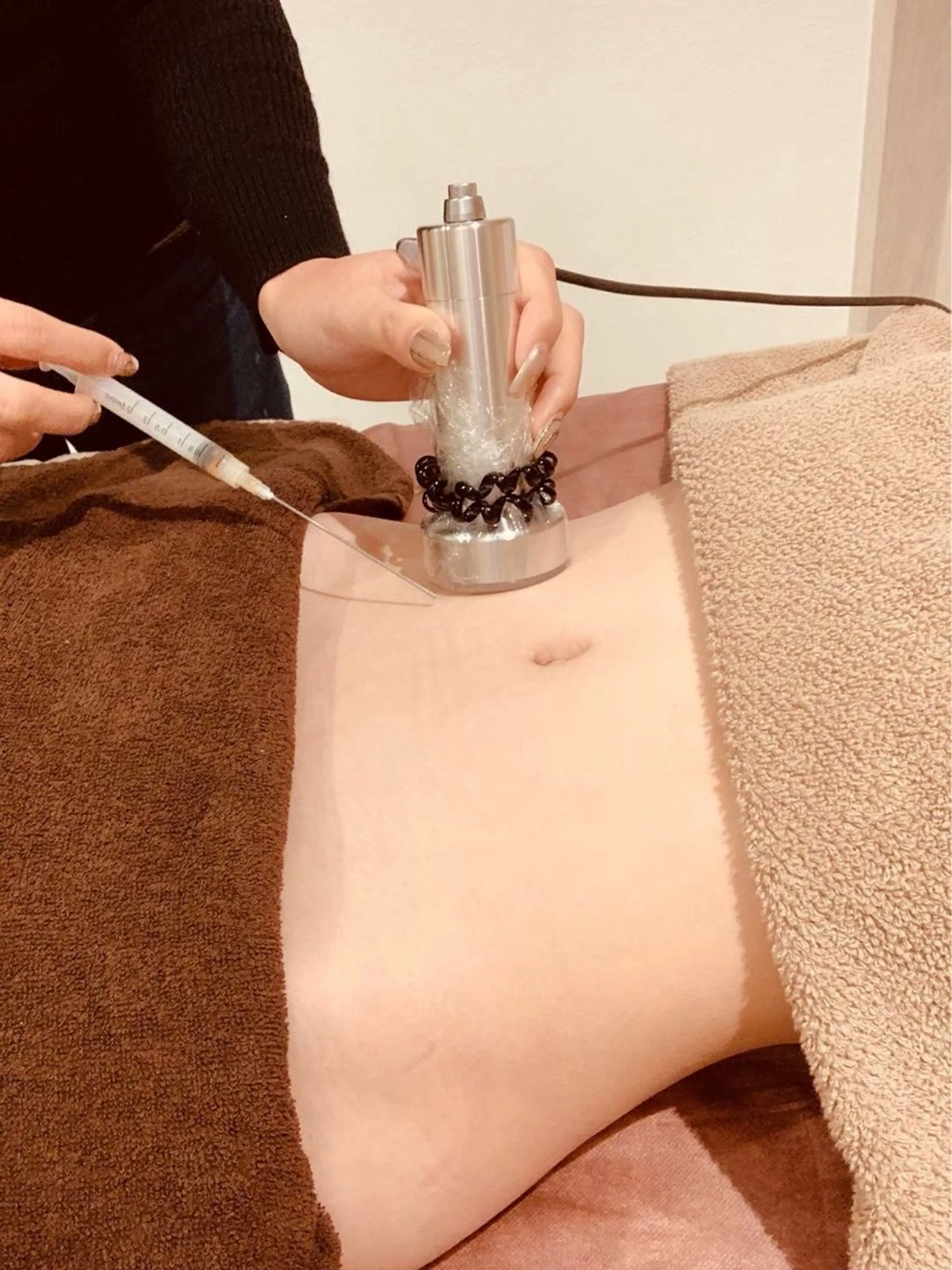 5月限定🌼ボディ痩身モニターメニュー👙夏までに間に合う！気になる脂肪にピンポイントでアプローチ！の写真