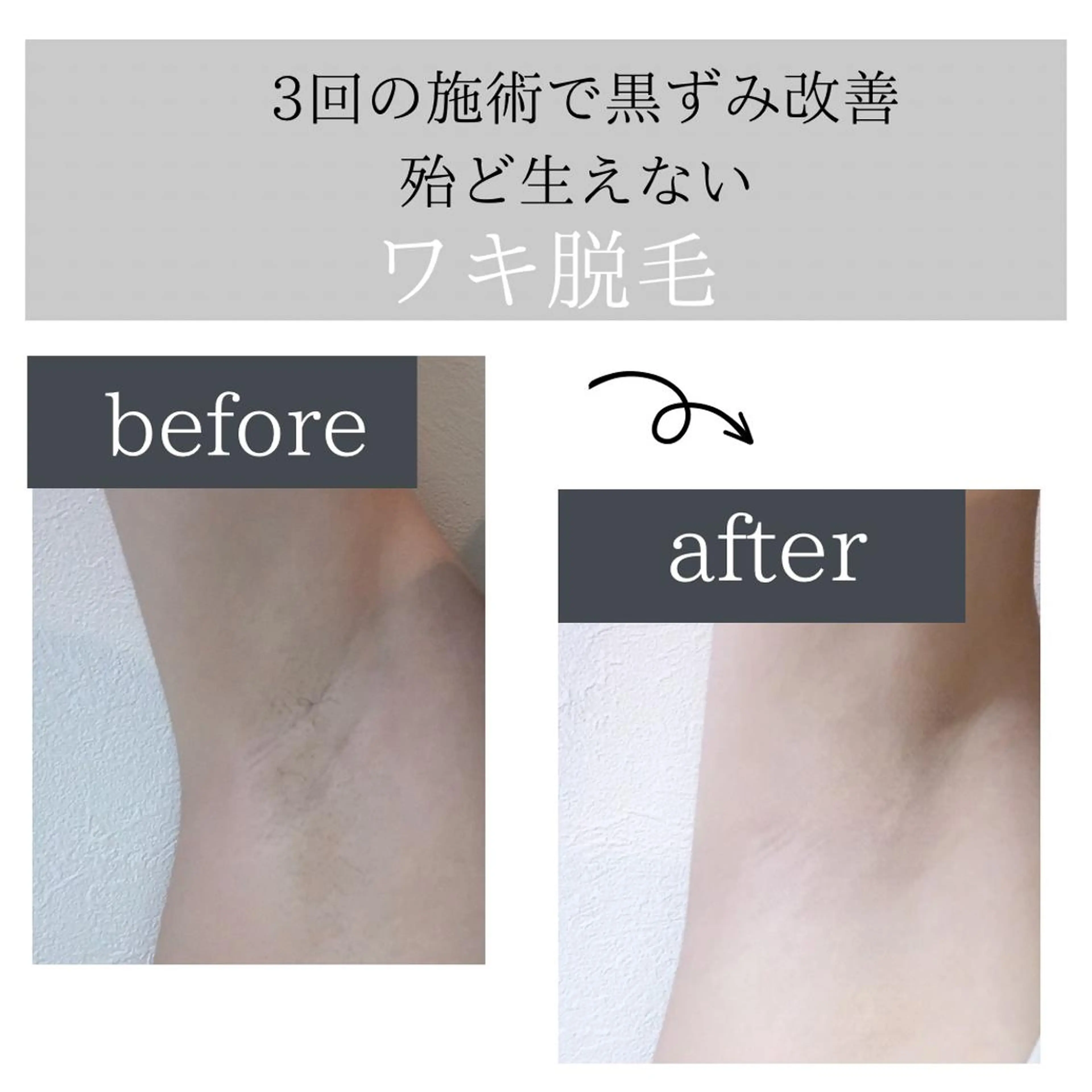 脱毛 脱毛サロン Lokahiのエステ・リラクイメージ