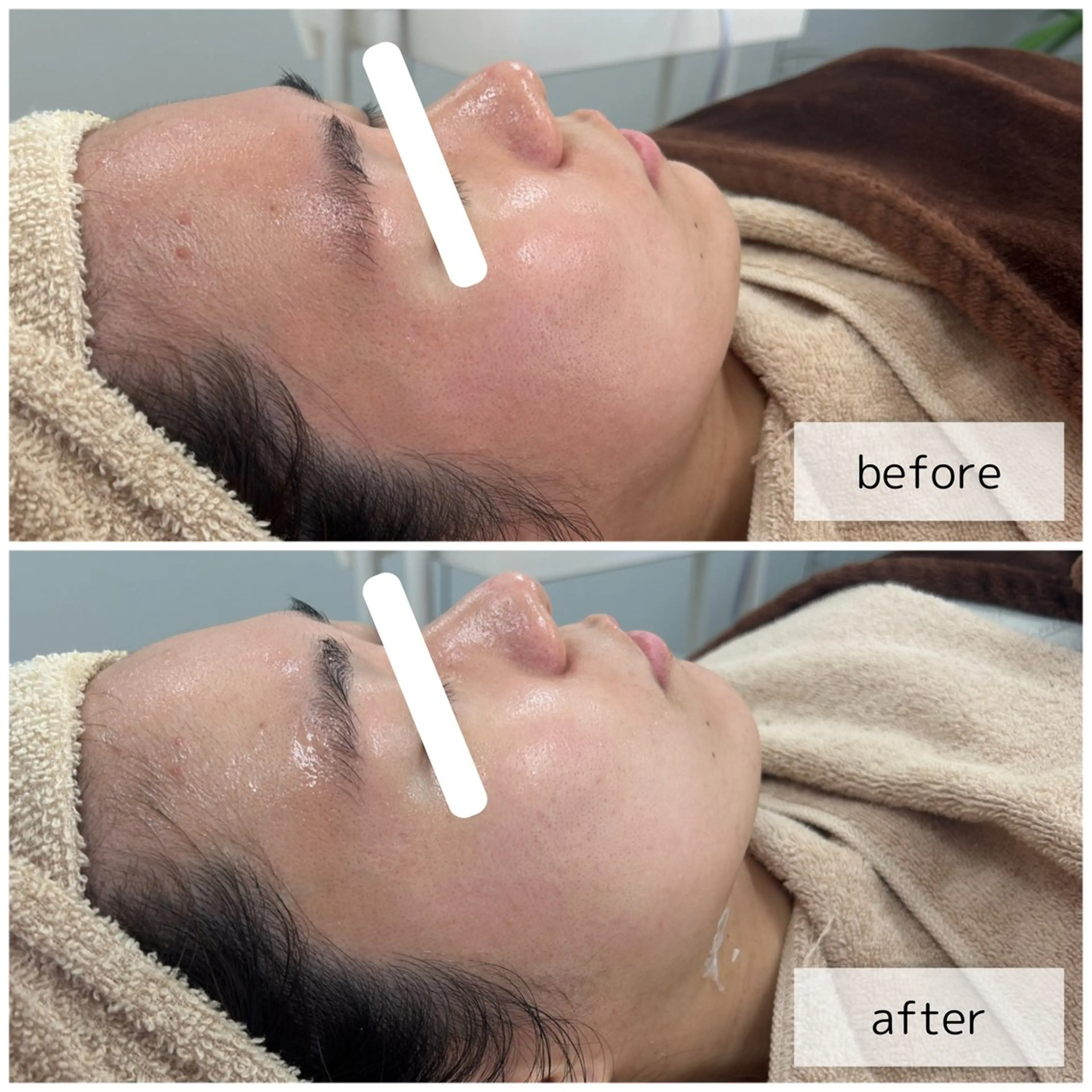 エステ エステサロン Venusのその他イメージ