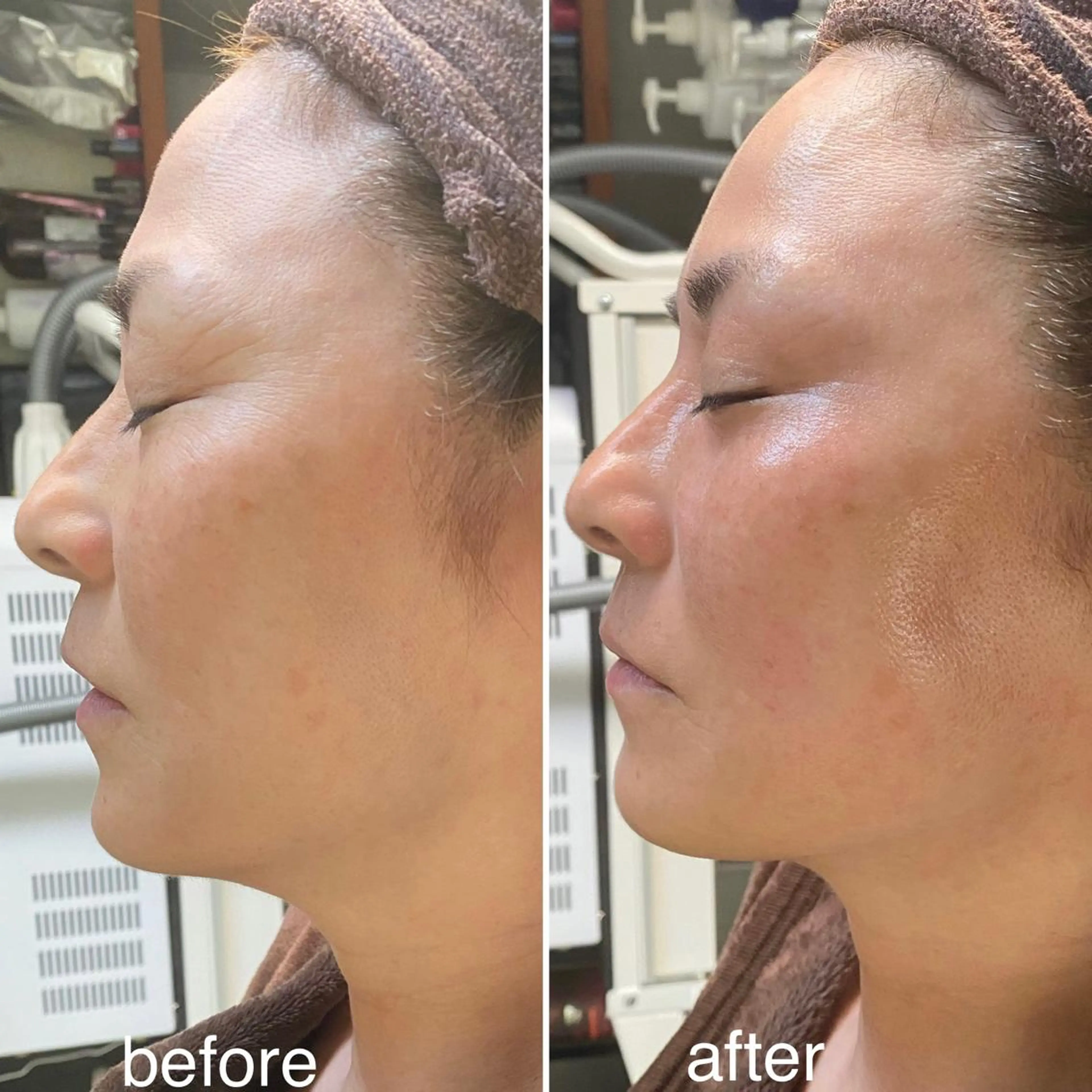 Ring -femのエステ・リラクイメージ