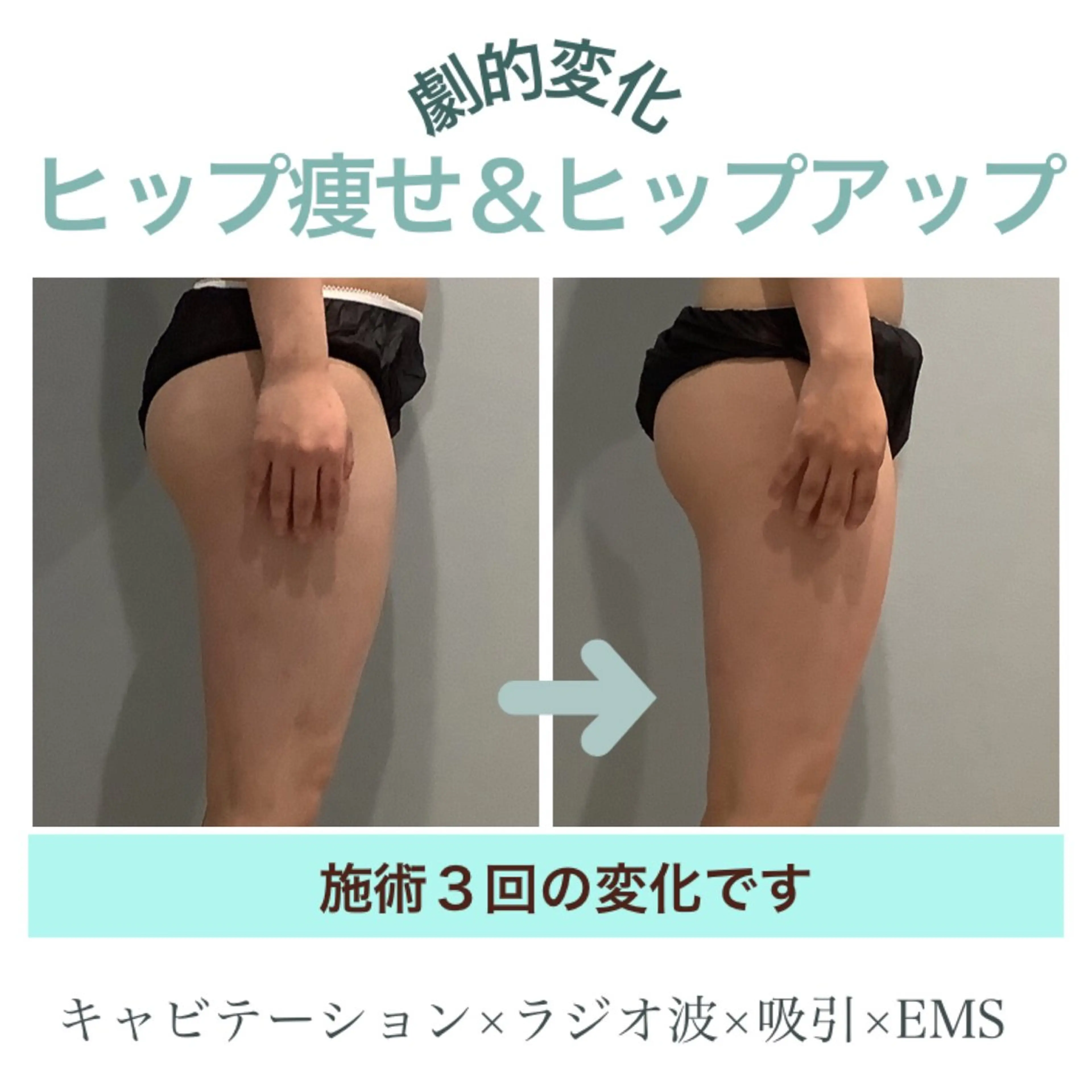 エステ エステサロン JURISのエステ・リラクイメージ