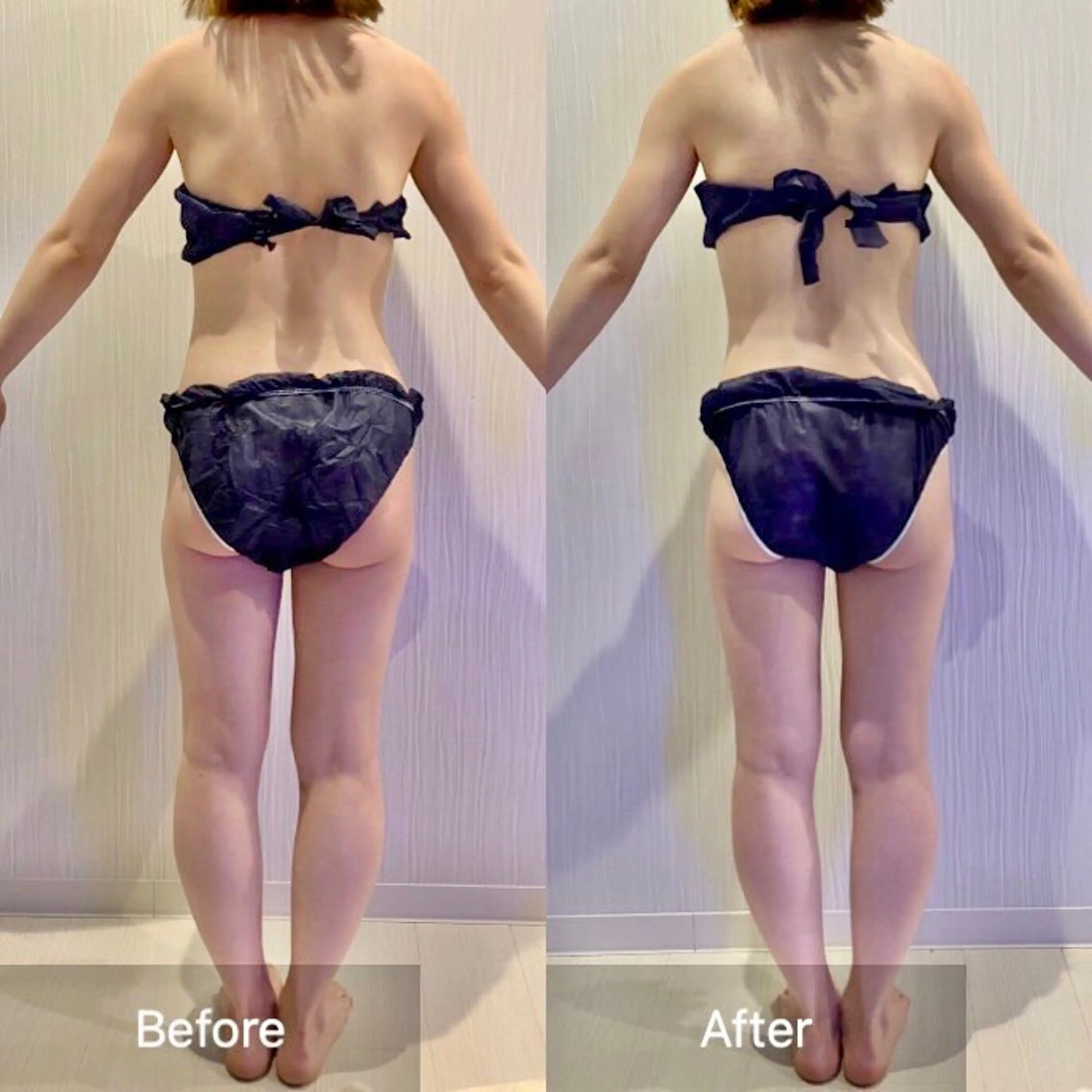 【脳洗浄/痩身】 nature東金のエステ・リラクイメージ