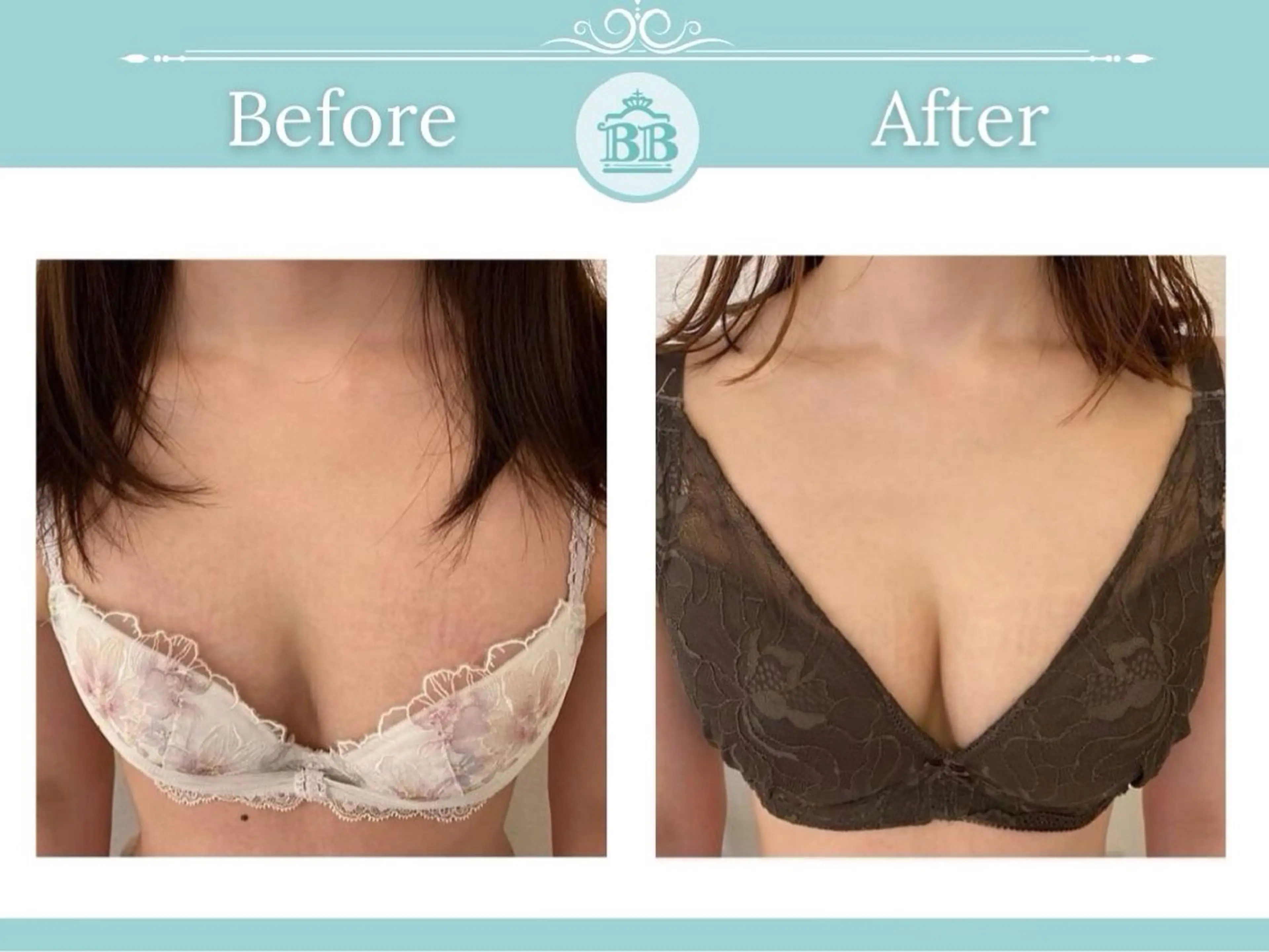 エステ 美人バスト 本厚木店のエステ・リラクイメージ