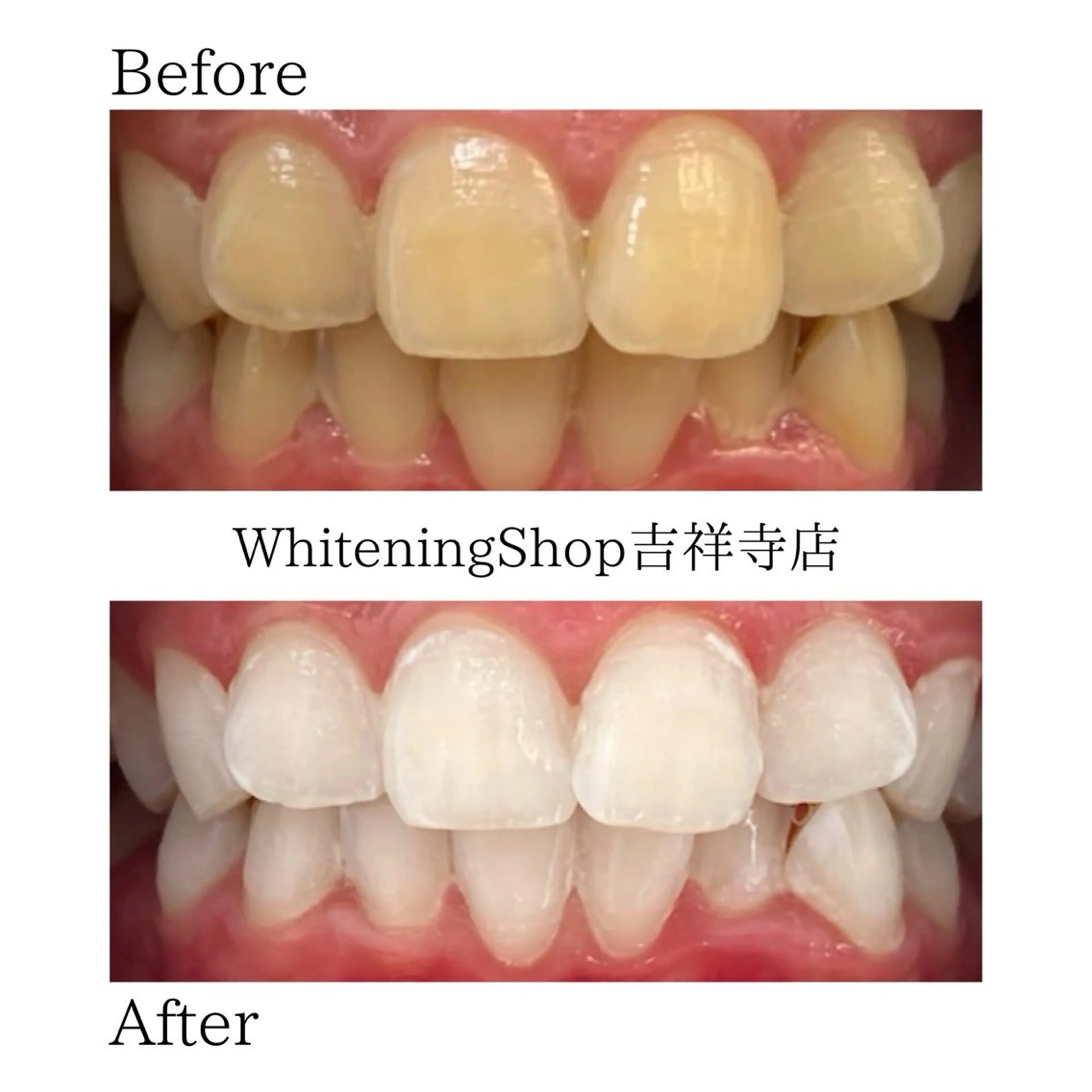 エステ リラク ホワイトニング ショップ吉祥寺店のエステ・リラクイメージ