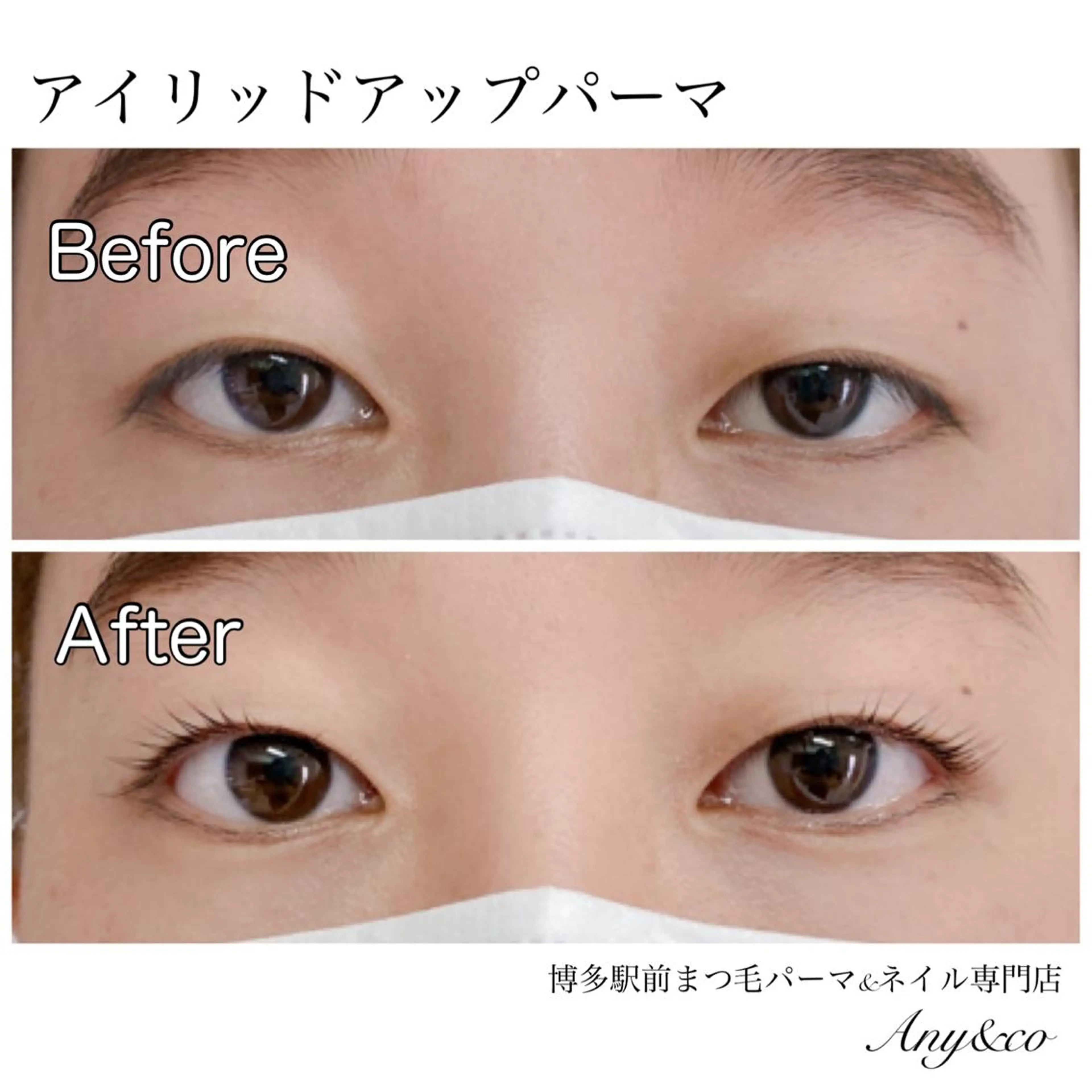 マツエク・マツパ アイリッドアップパーマ 一重×まつ毛パーマ Any&co 【エニコ】のマツエク・マツパデザイン