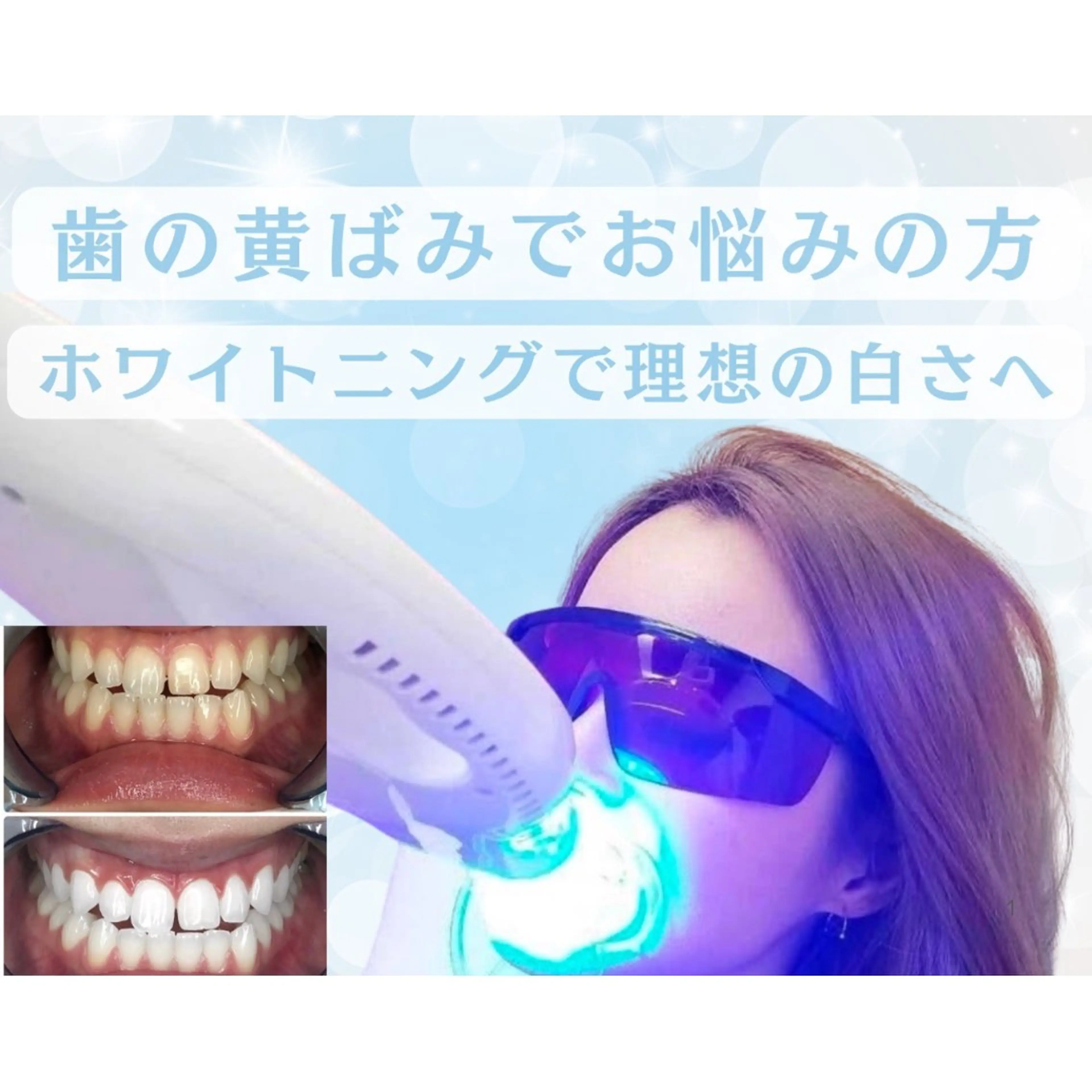 Whitening Beauty 行橋店のその他イメージ