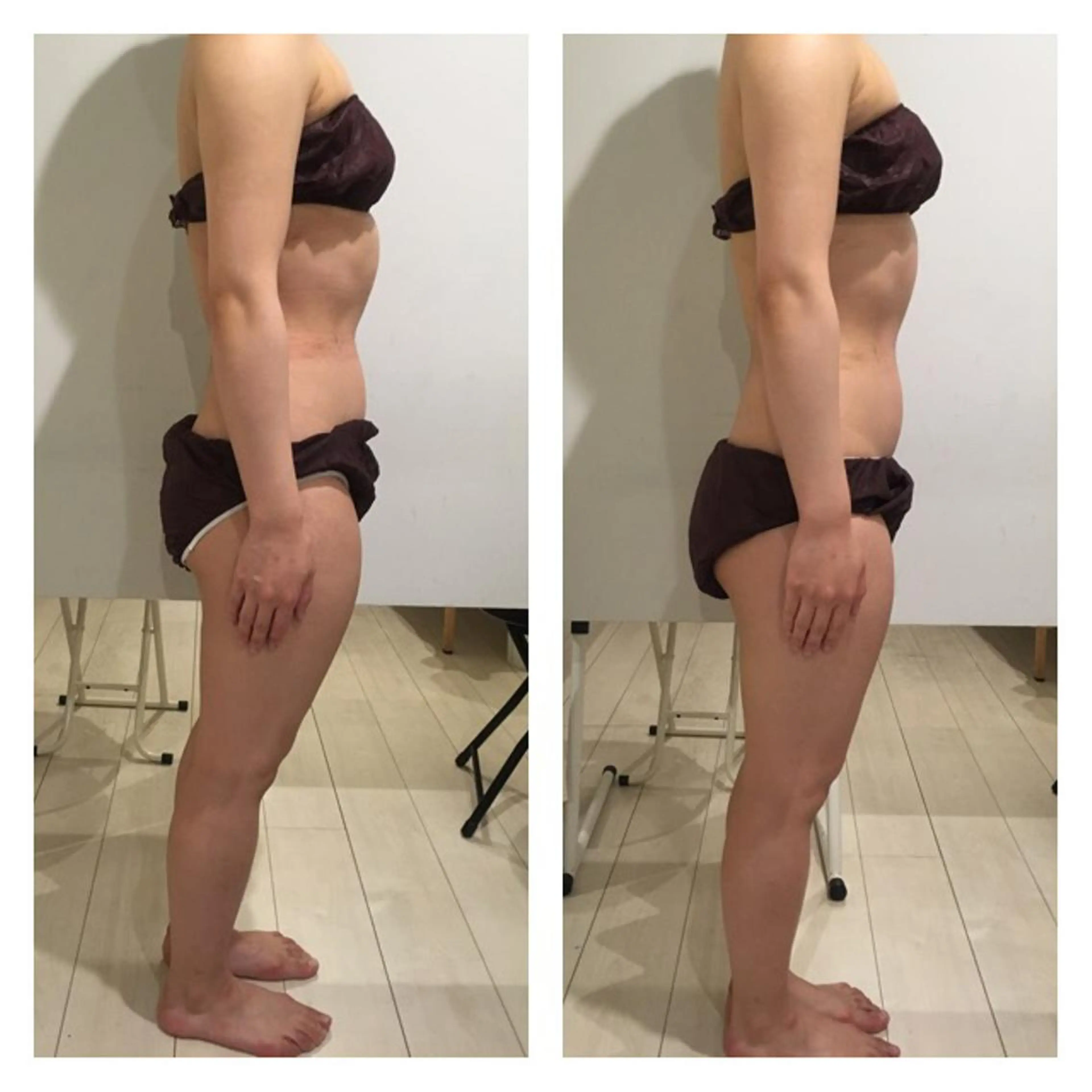 アニメ,Vオタク× 即効痩せエステサロンのエステ・リラクイメージ