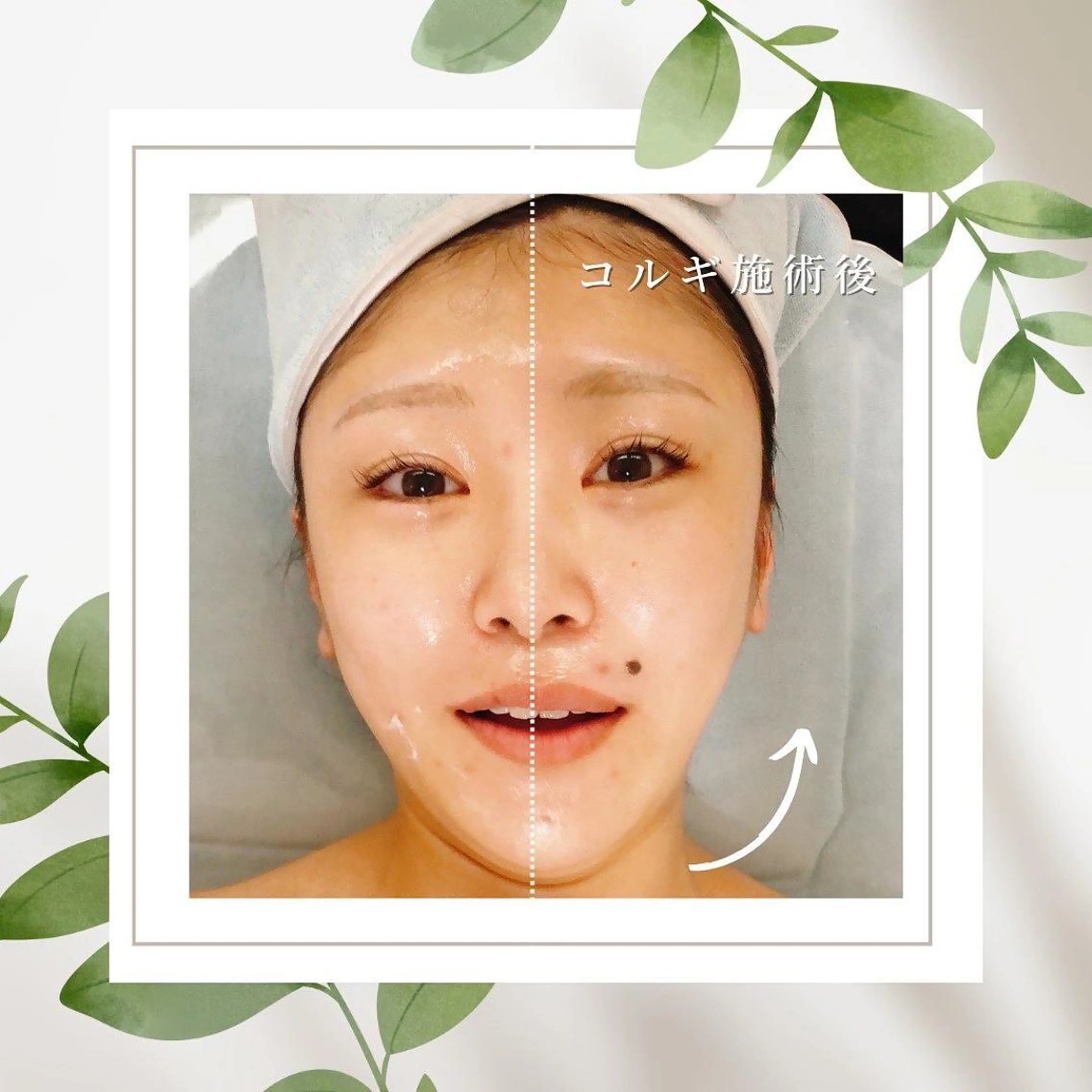 【大人気★小顔&肩こり◎】コルギ＋デコルテケア＋パックの写真
