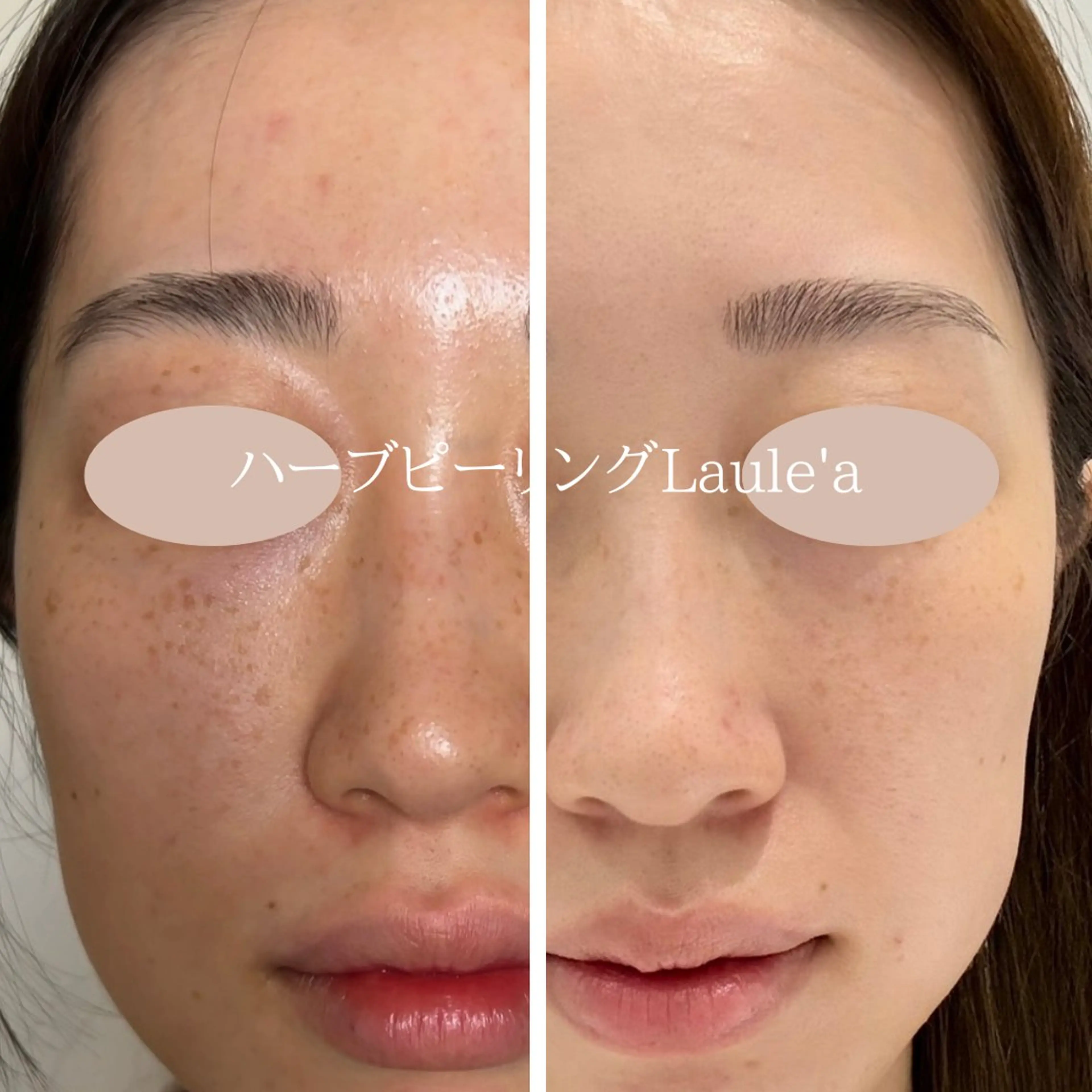 美腸サロン🌺 腸もみ/小顔/リンパのエステ・リラクイメージ