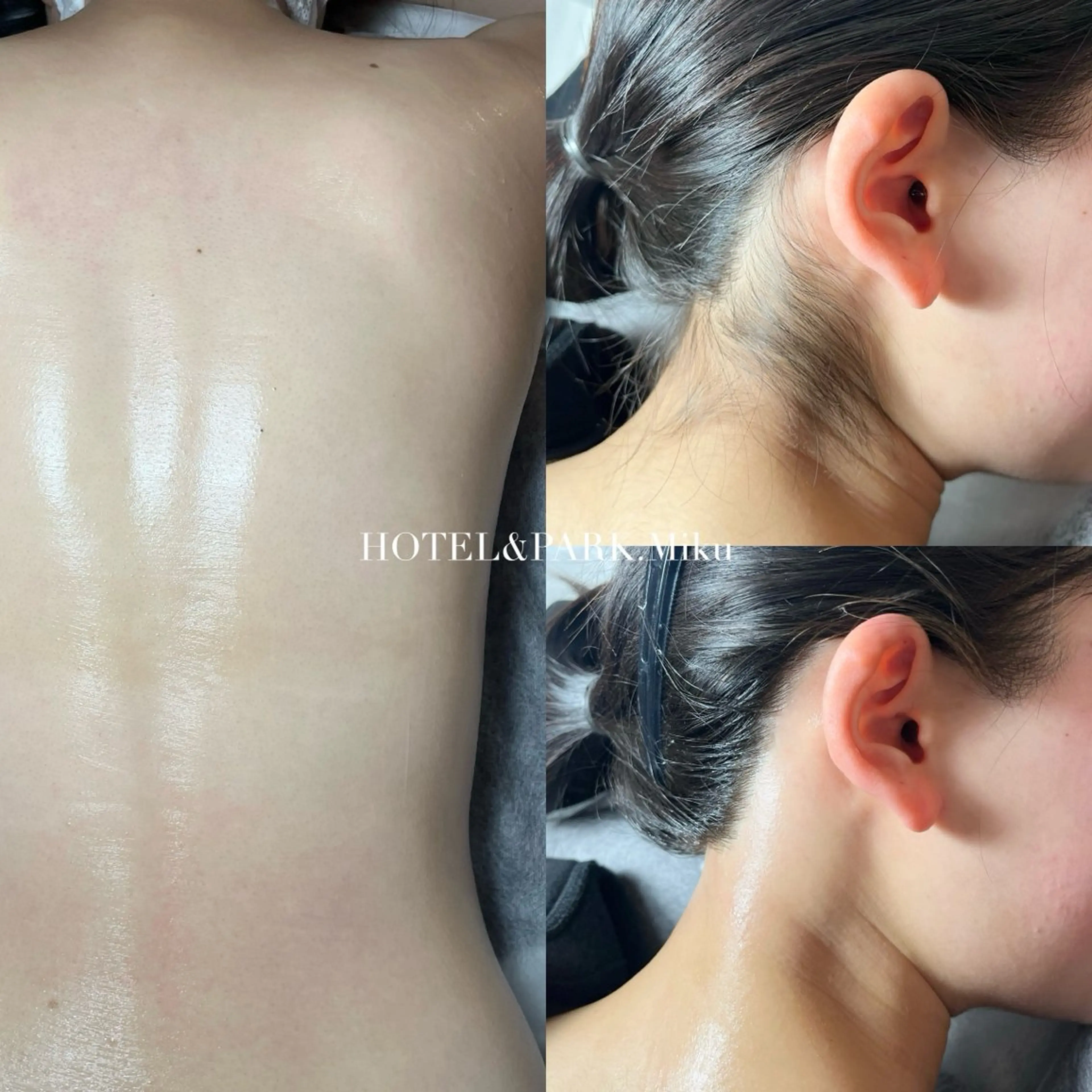 4/12限定🫧【背中ALL(うなじ込)ワックス脱毛】*鎮静パック付の写真