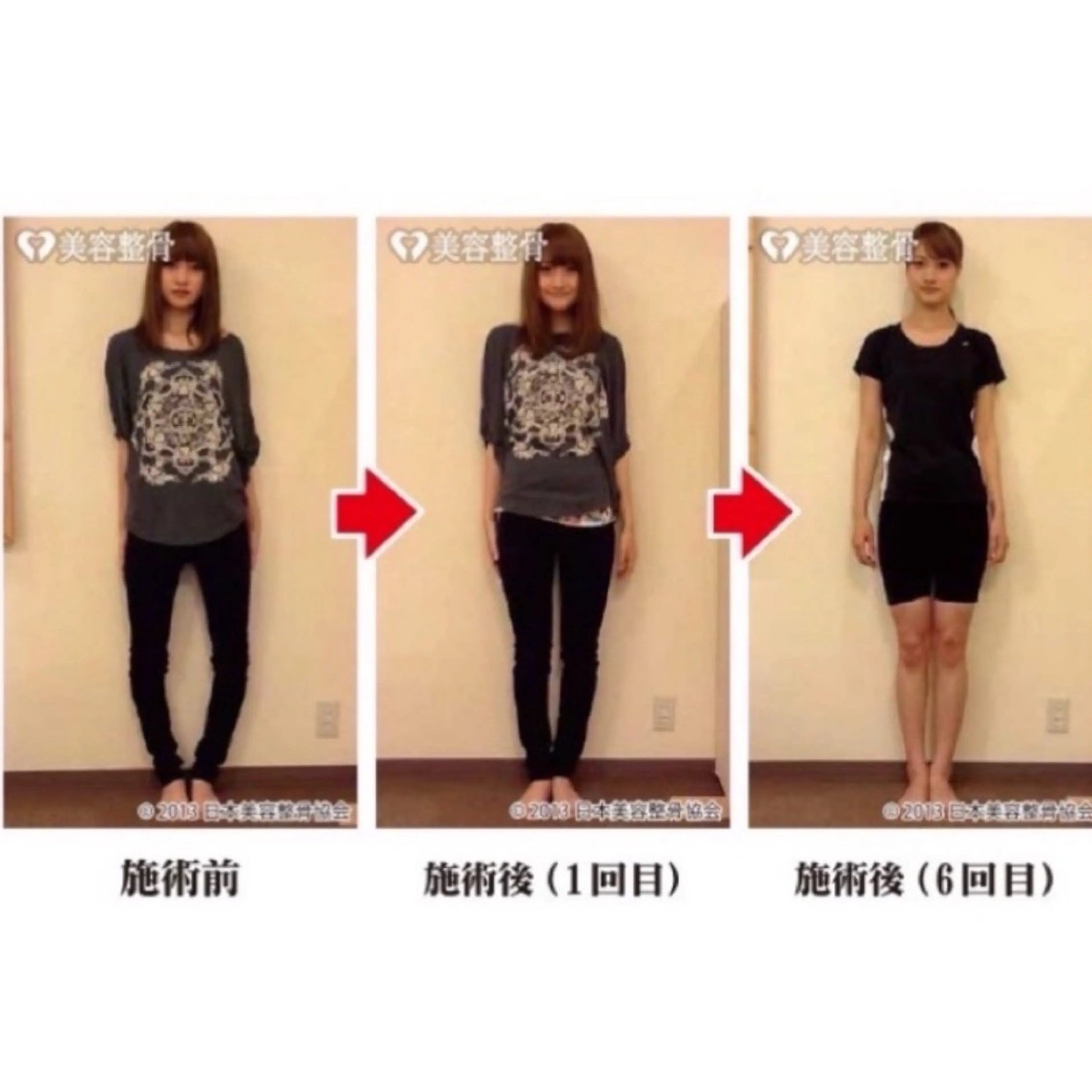 【メンズok】猫背肩こり/肩こり、首こりに全身姿勢矯正！歪みを整え、筋疲労にアプローチの写真