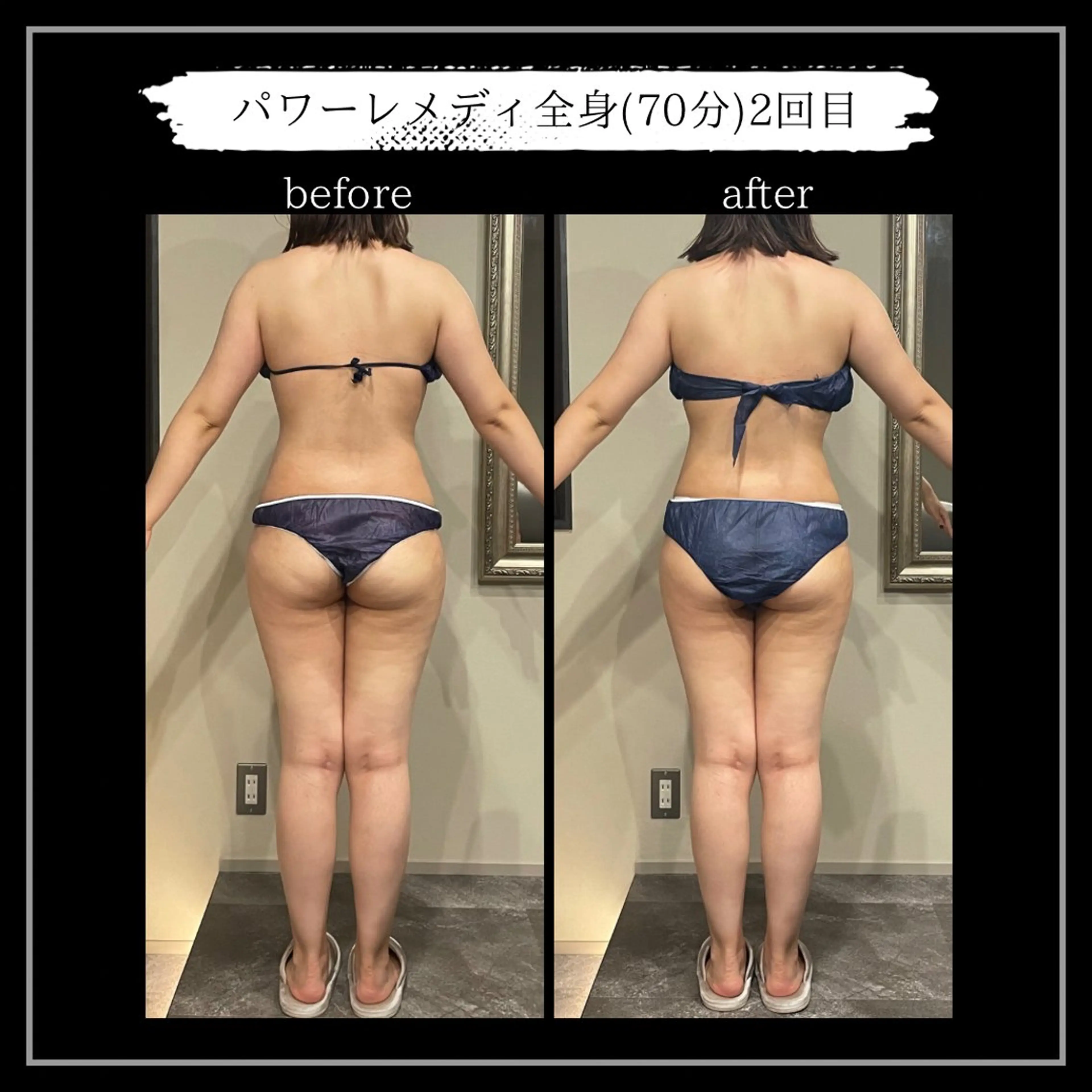 オフ:オン 全身筋膜マッサージのエステ・リラクイメージ