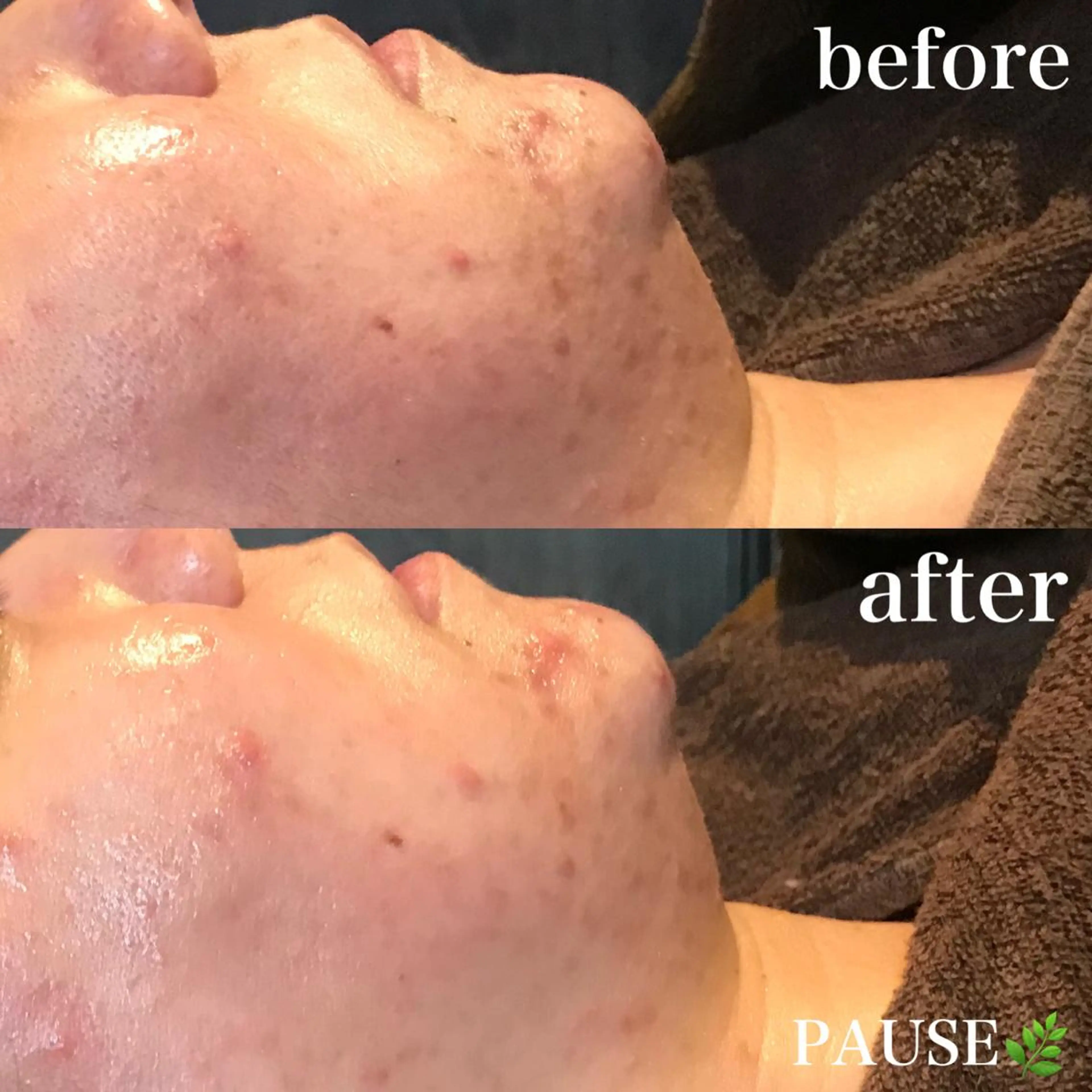 エステ 浜野 恵美のエステ・リラクイメージ