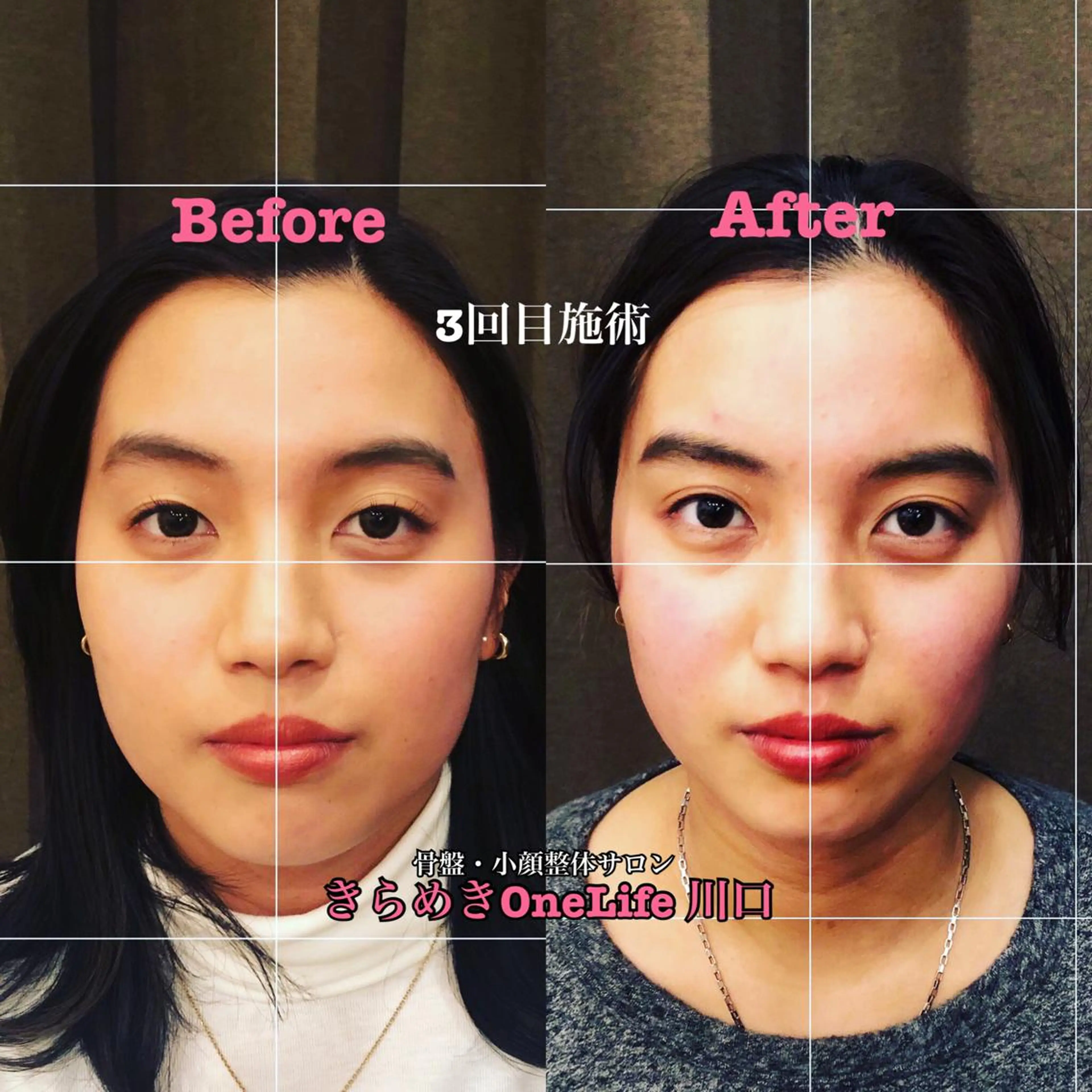 エステ リラク きらめきワンライフ Yumaのエステ・リラクイメージ