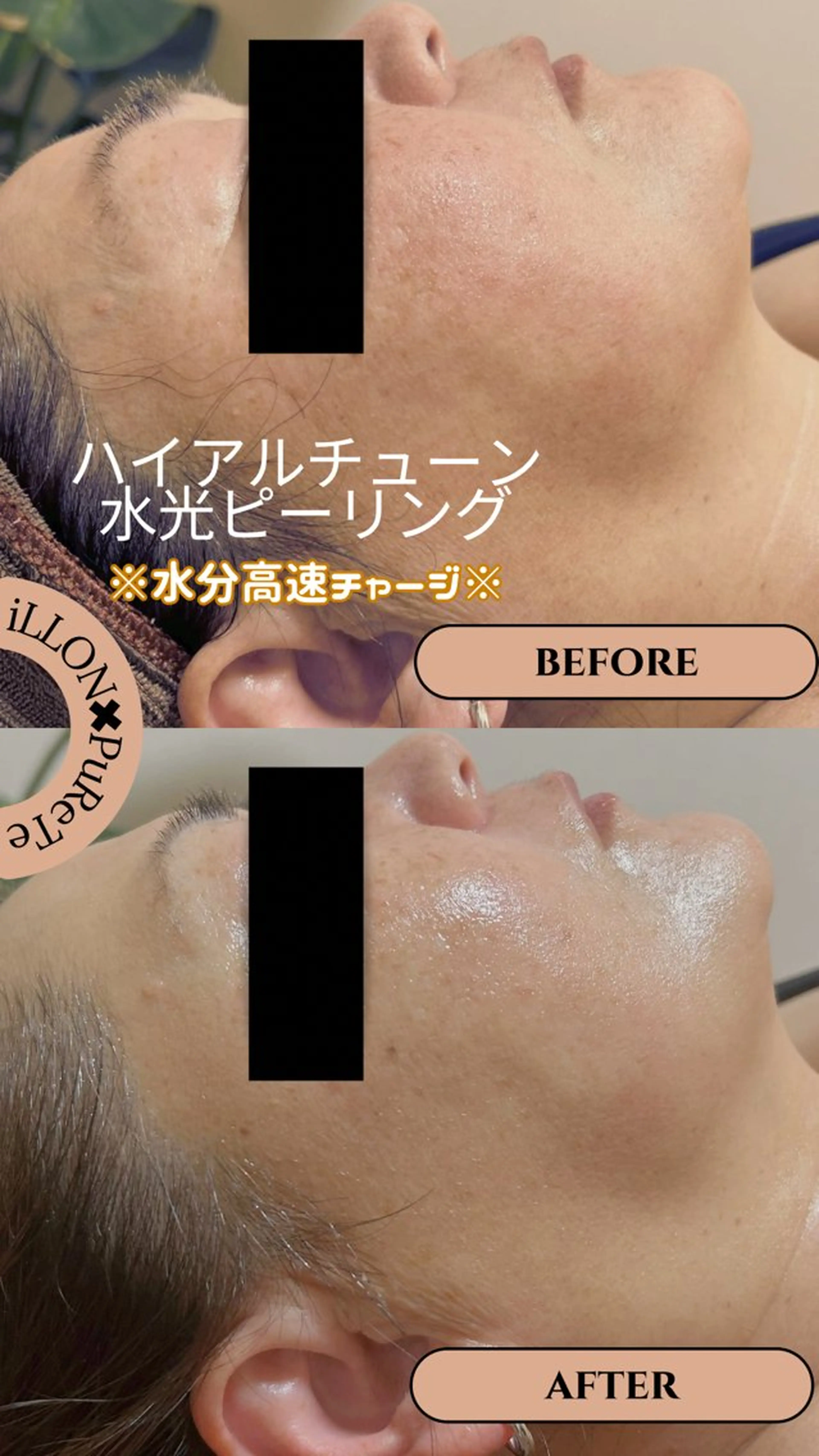 エステ リンパ・小顔サロン PuReTeのエステ・リラクイメージ