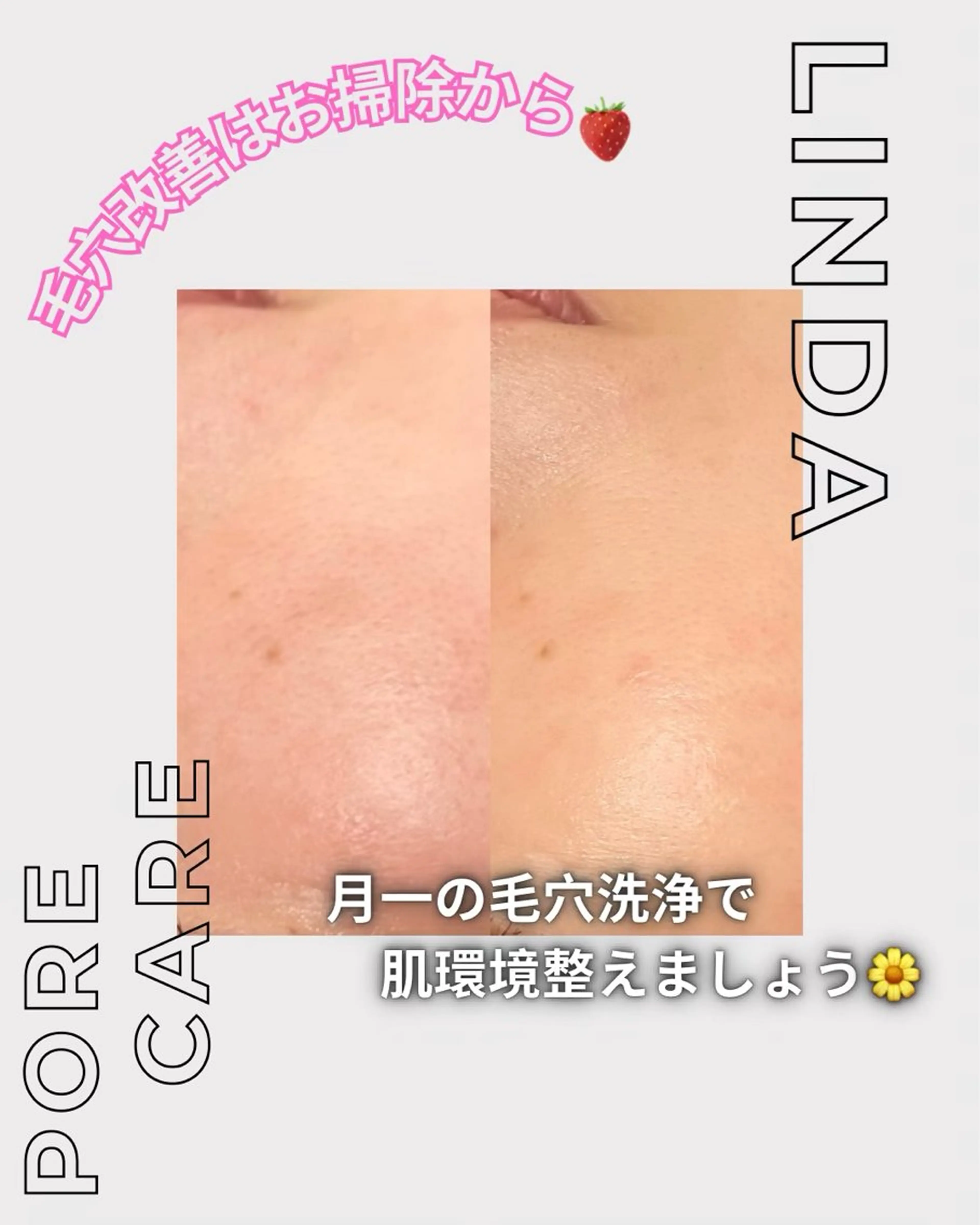 エステ 小顔&毛穴・肌質改善 LINDA西宮 AIのエステ・リラクイメージ