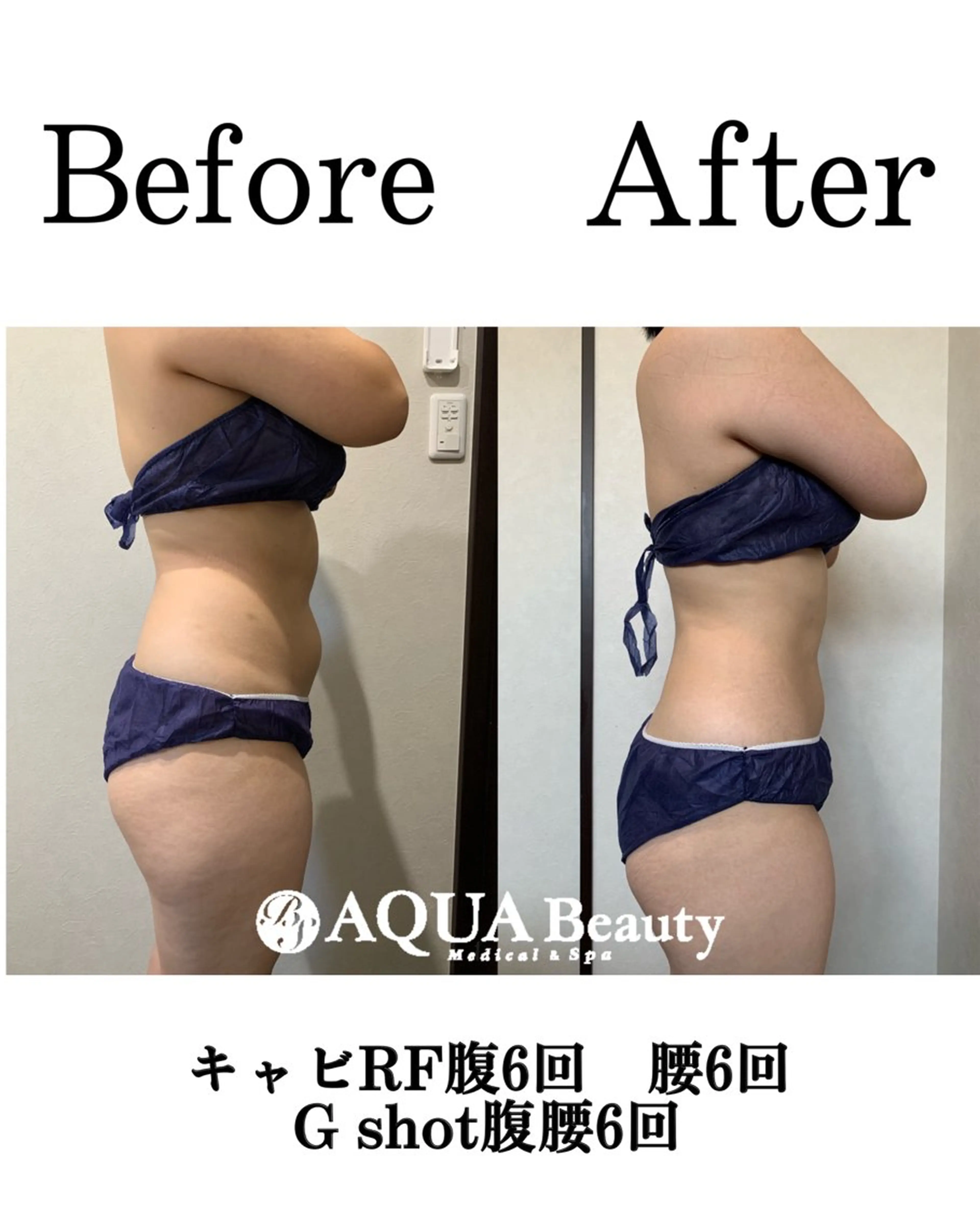 エステ 松島 愛莉のエステ・リラクイメージ