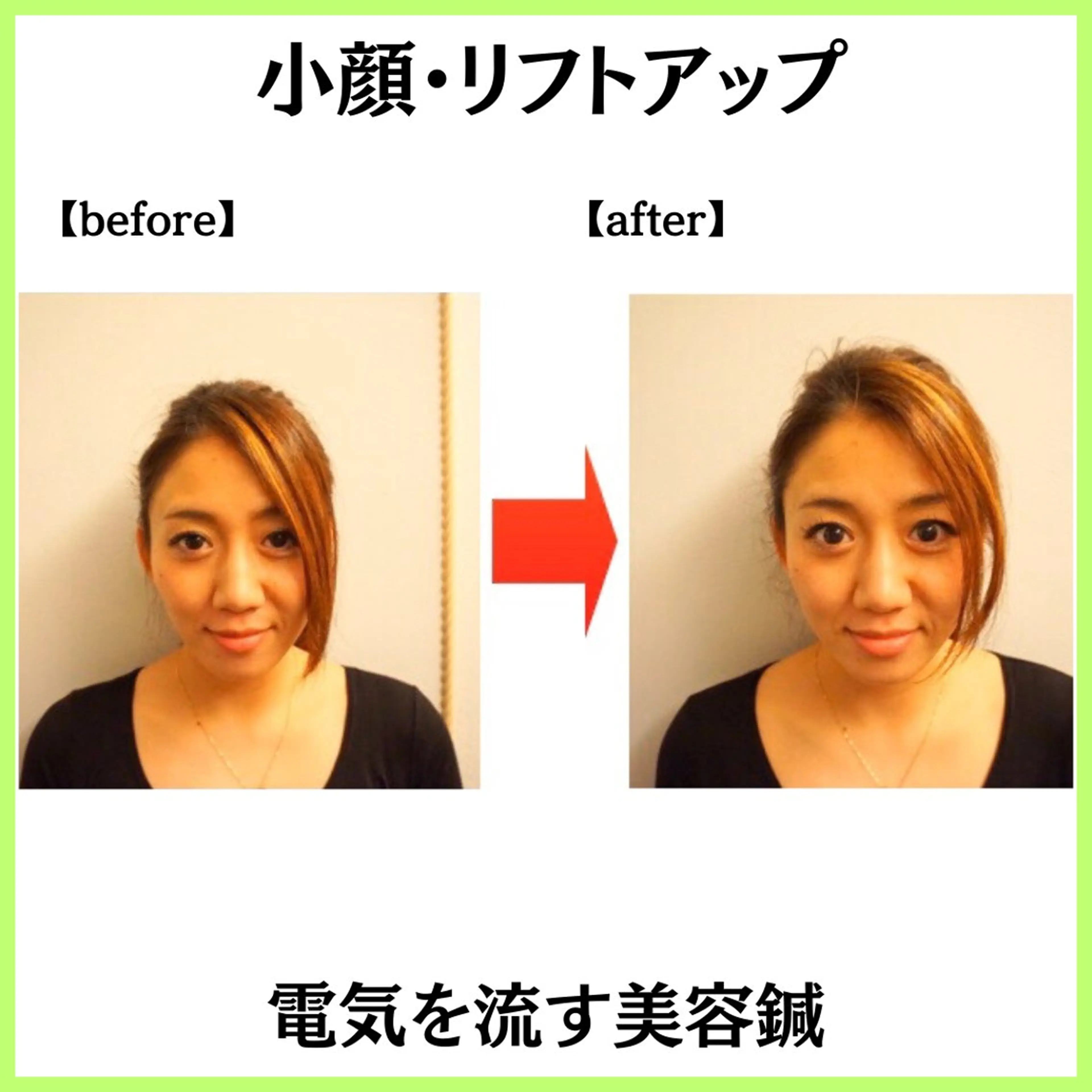 小顔ハーブピーリング 美容鍼/毛穴洗浄のエステ・リラクイメージ