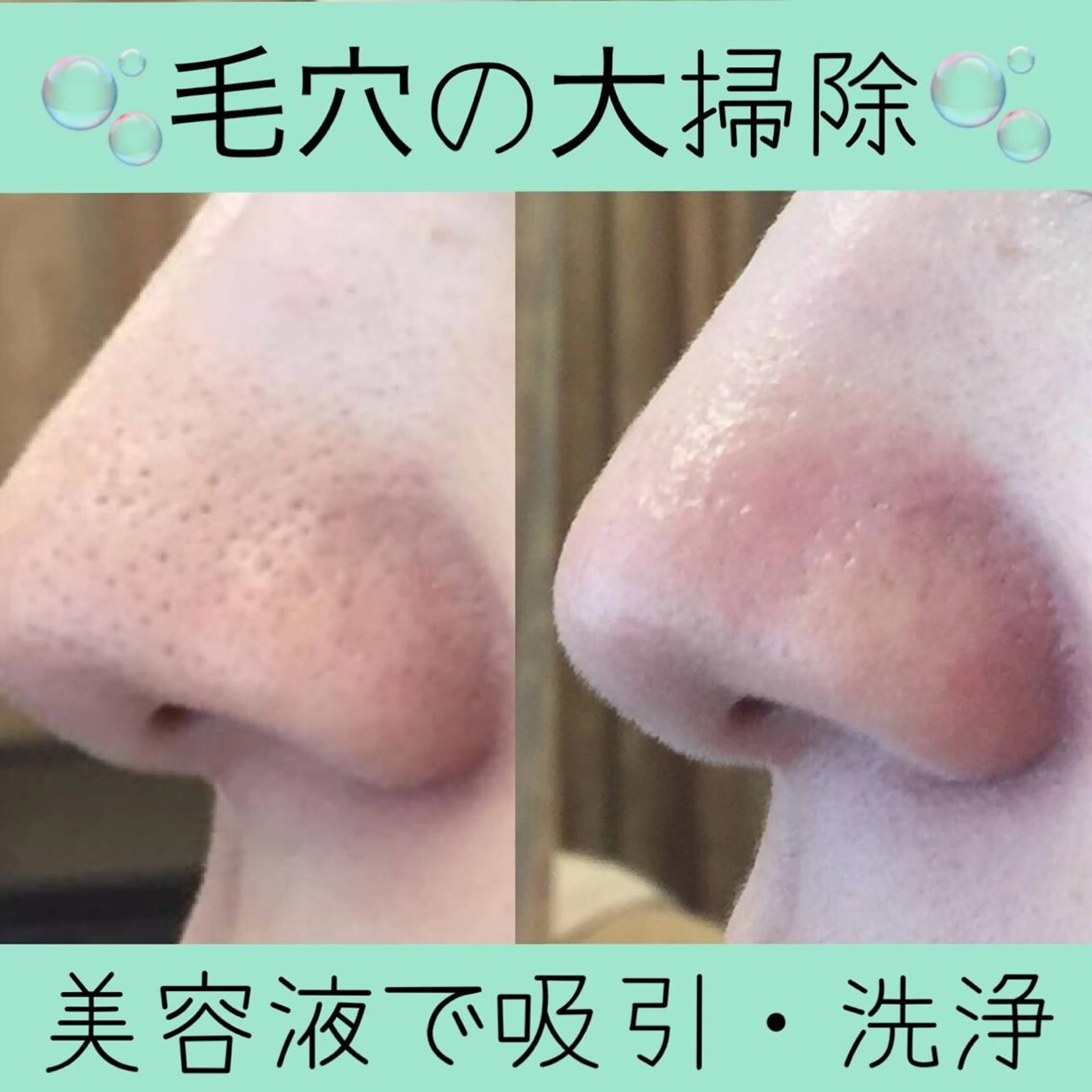 【医療提携サロン】 OFF〜脱毛＆美肌〜のエステ・リラクイメージ