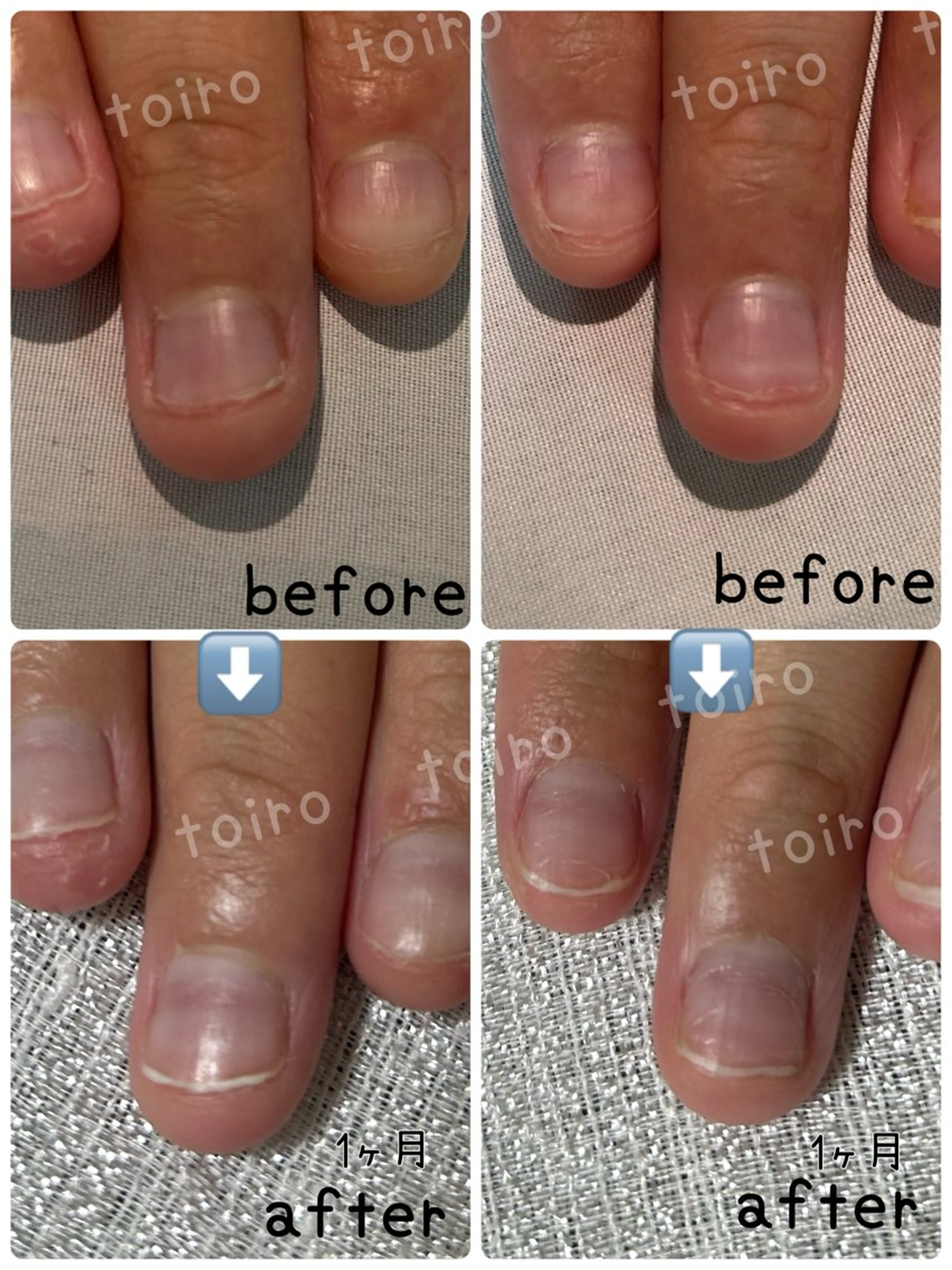 ネイル ネイルケア&自爪育成 専門サロンToiroのネイルデザイン