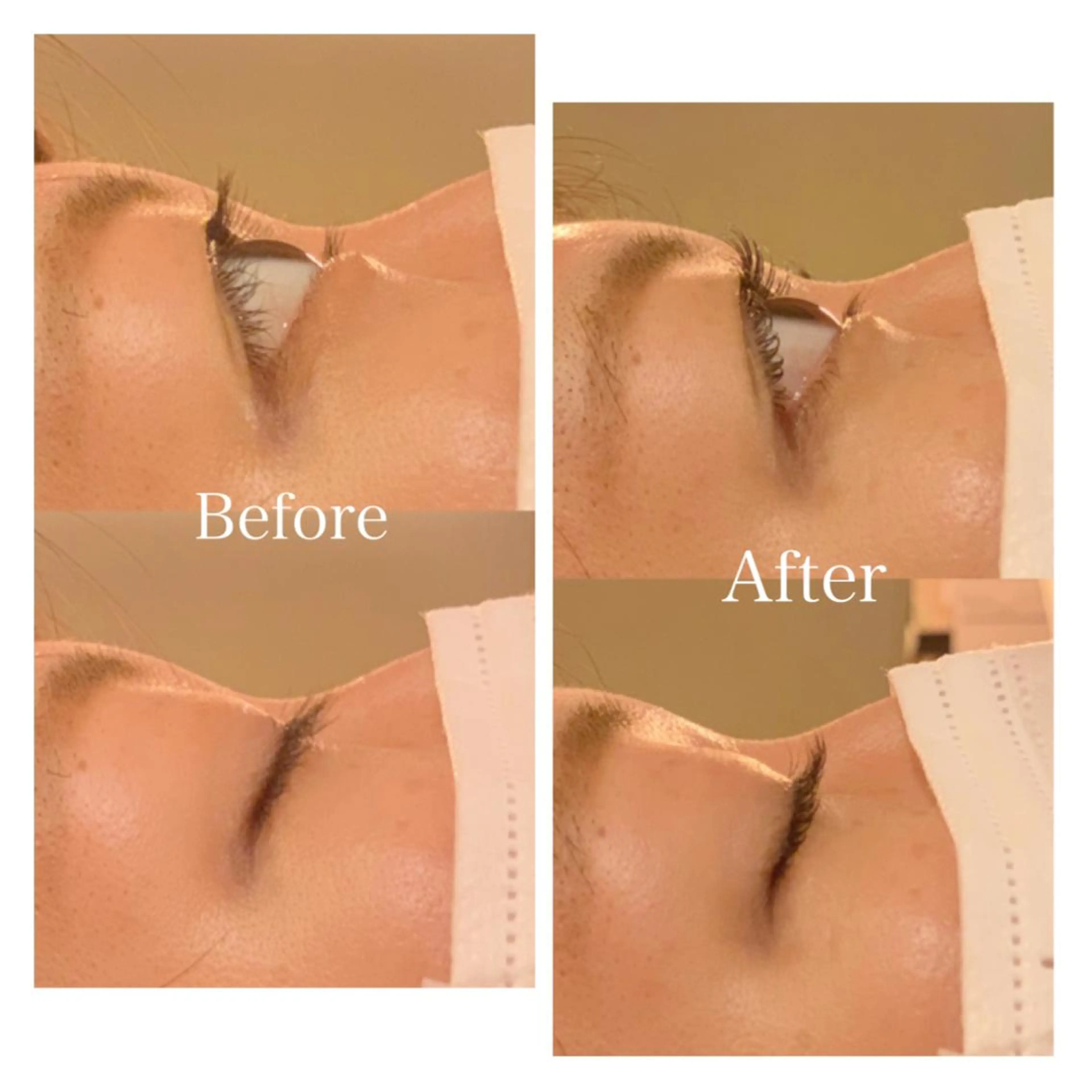 マツエク・マツパ 西岡 美香子のネイルデザイン