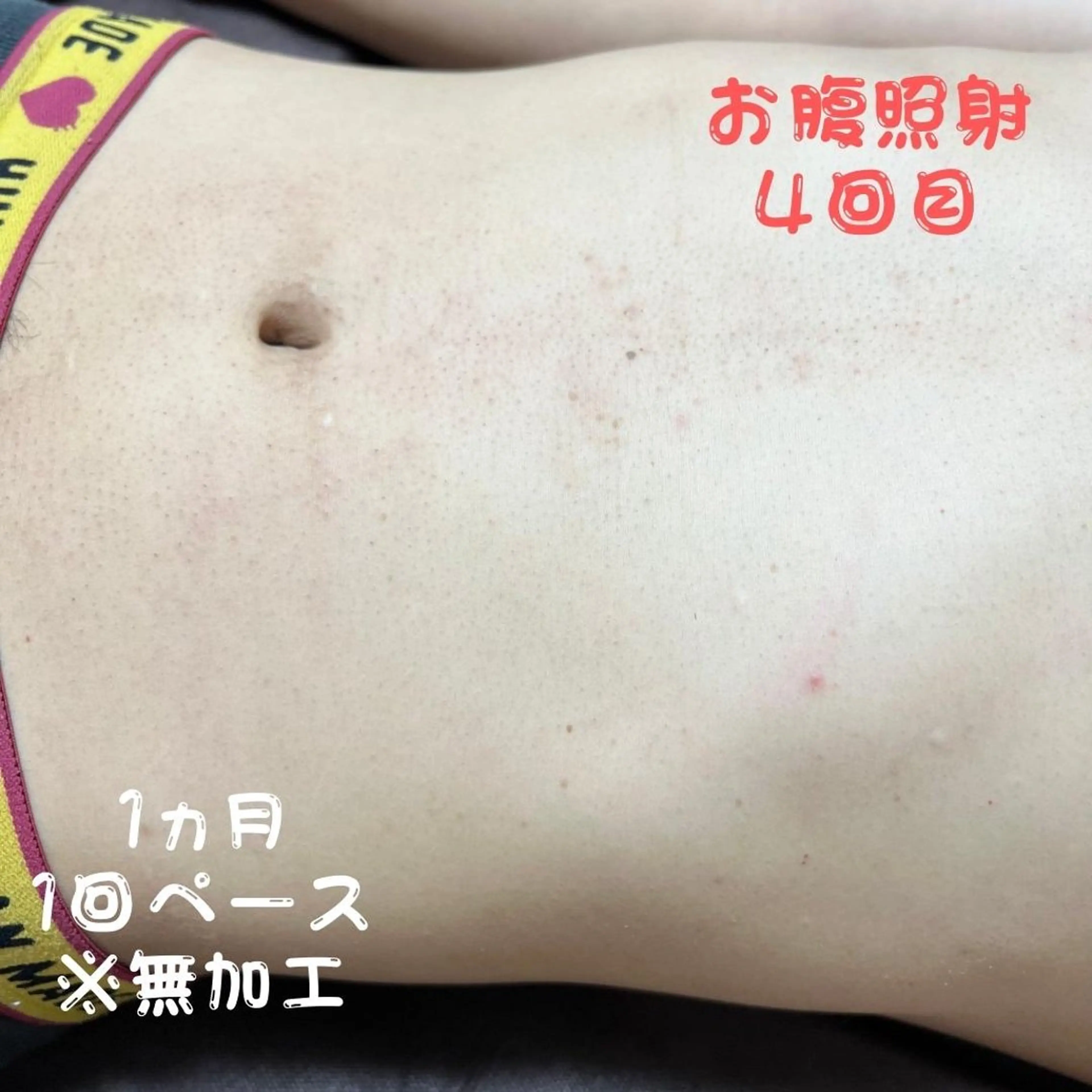 メンズ キッズ 脱毛 メンズ脱毛フェリッセ /男女🆗キッズ🆗のエステ・リラクイメージ