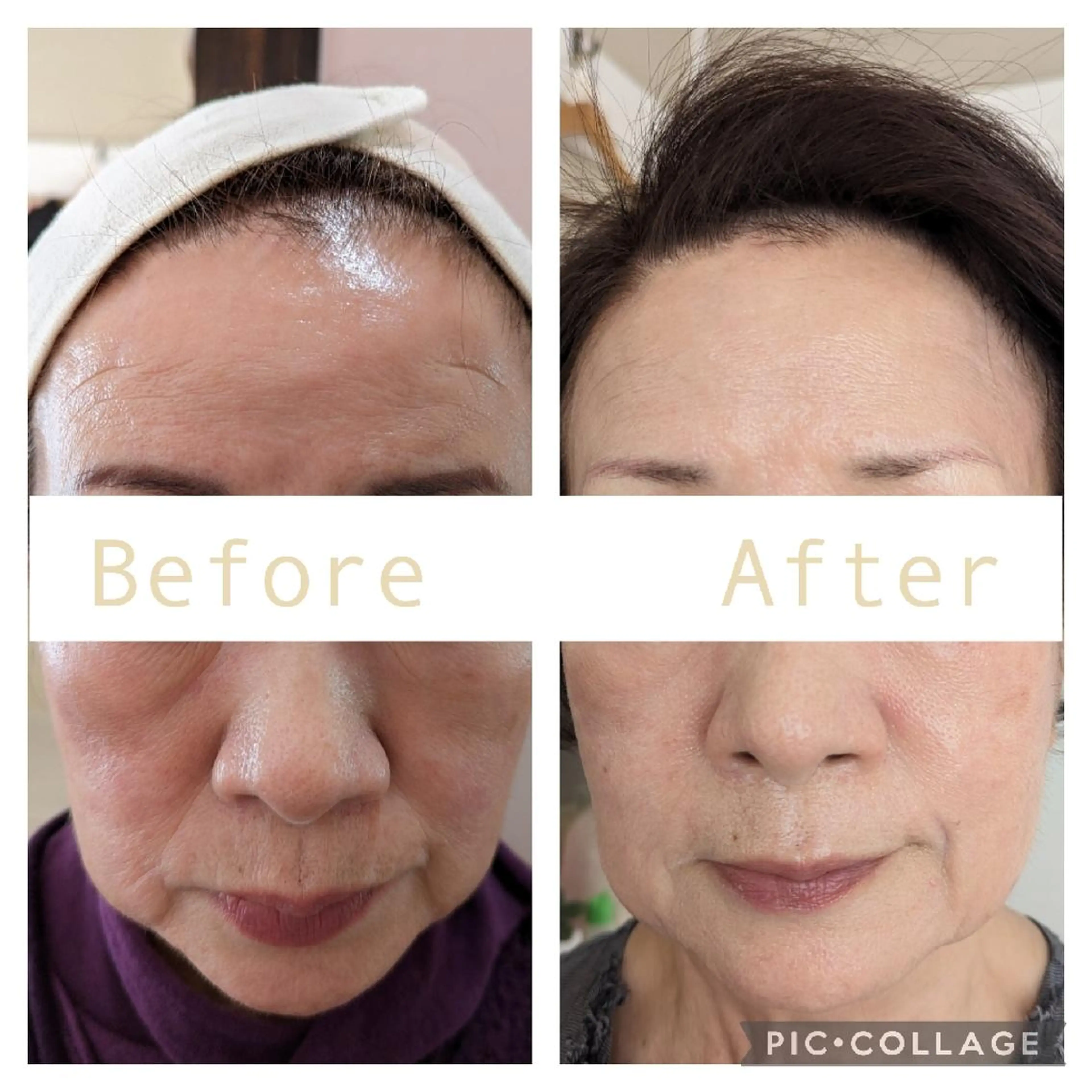 たるみ/小顔/毛穴 エミリーノ米田真美子のエステ・リラクイメージ