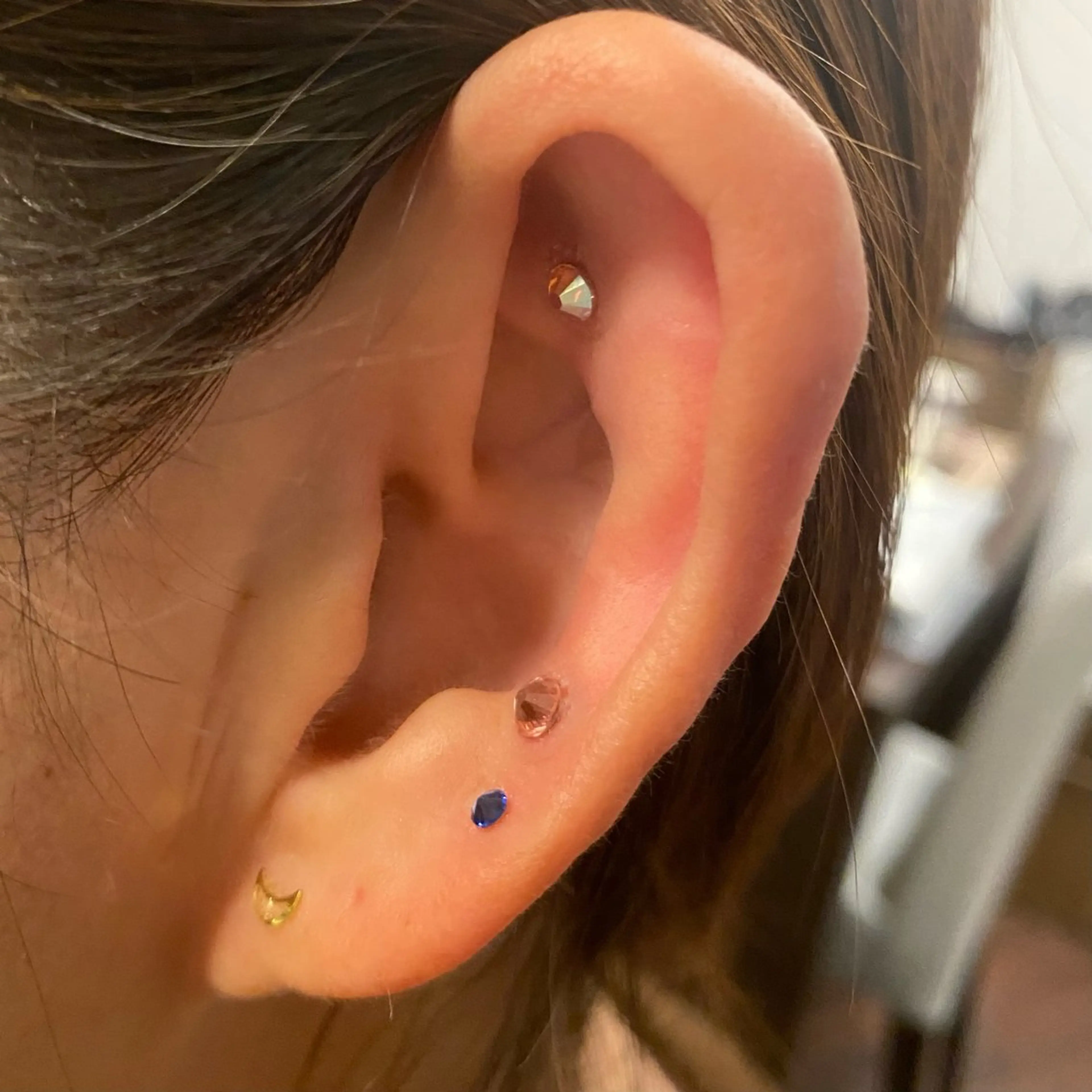 その他 【毛穴・美白・美肌】 美・up 青葉台店のエステ・リラクイメージ