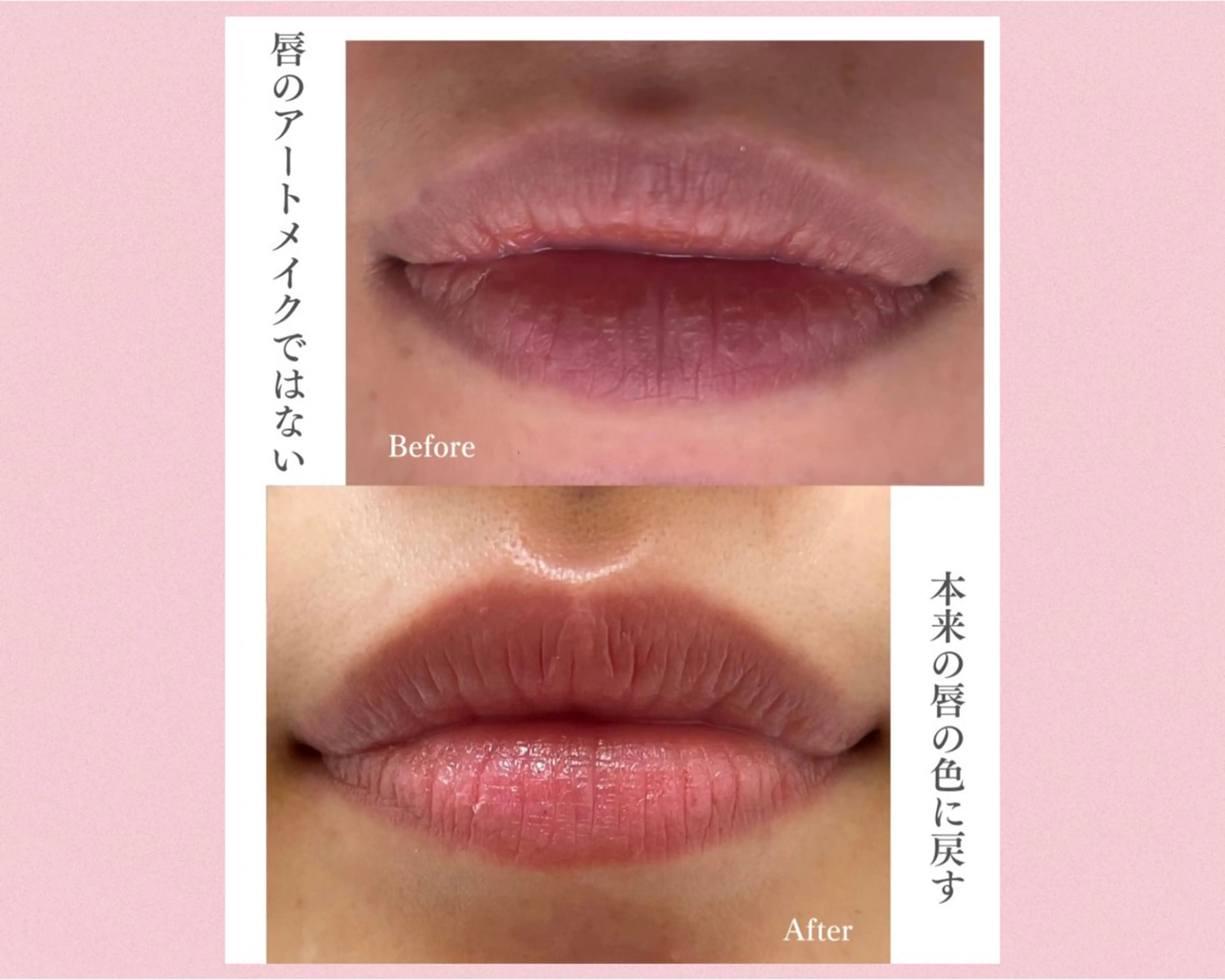 メンズ脱毛サロン BRIGHTのエステ・リラクイメージ