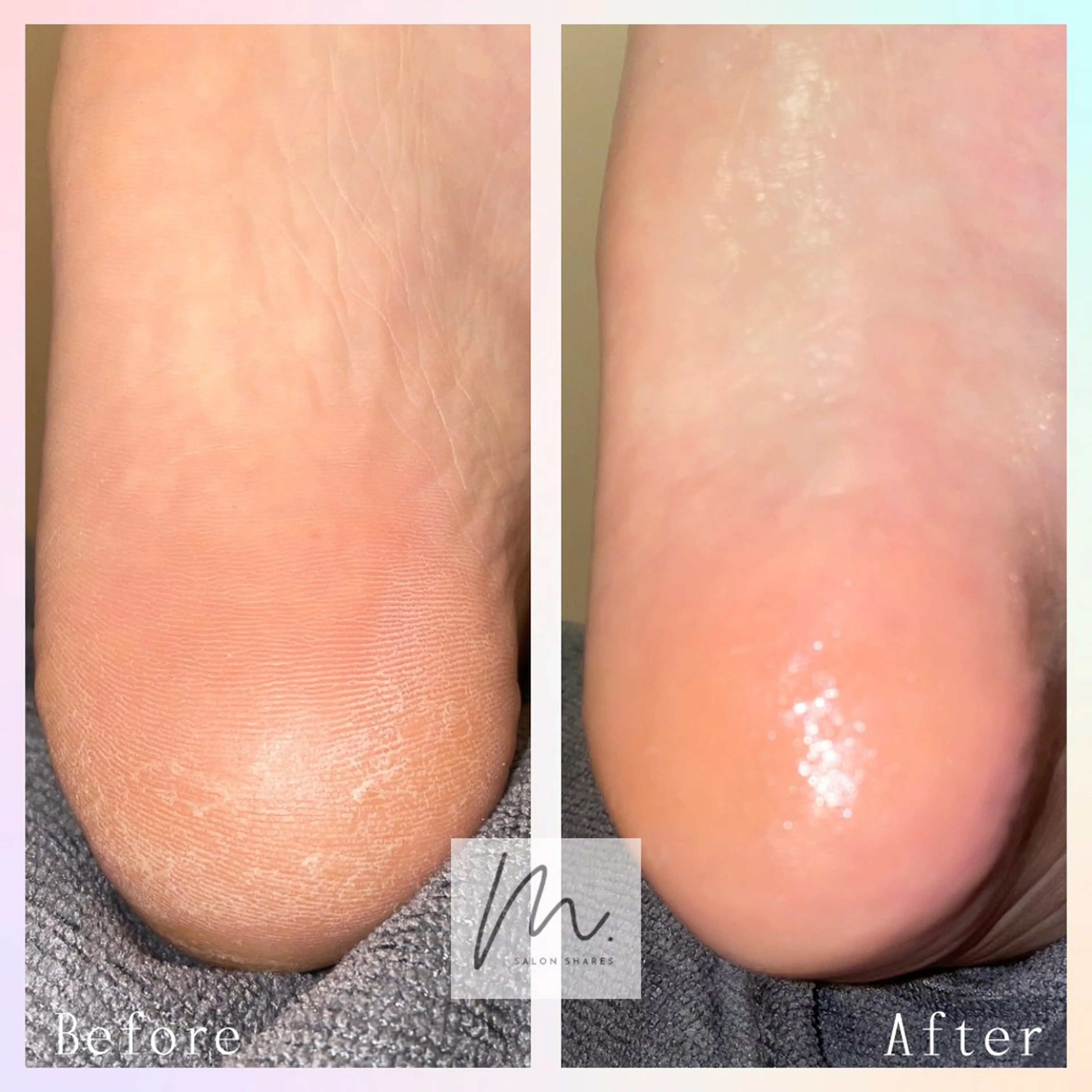 SHARES MADOKAのエステ・リラクイメージ