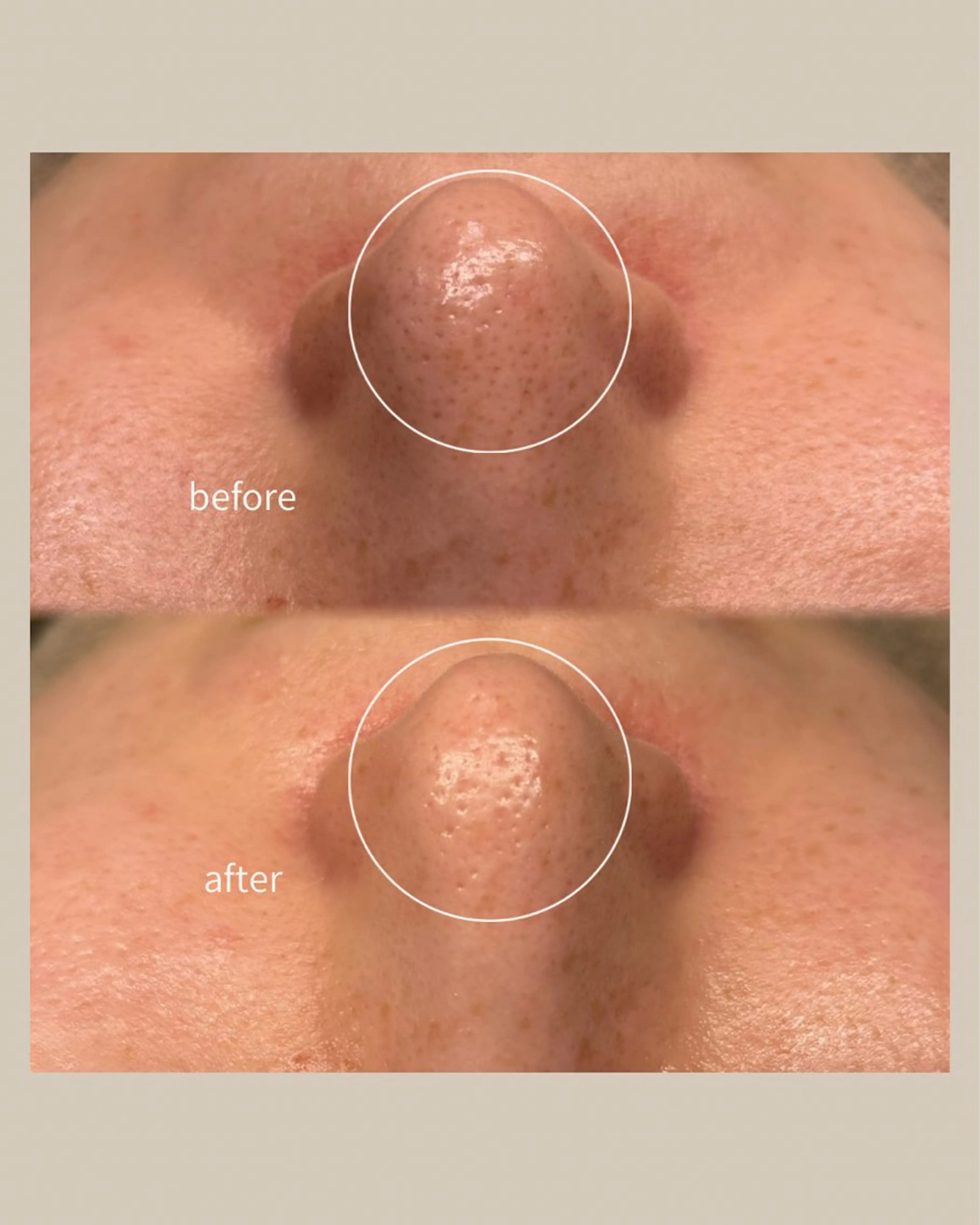 エステ 毛穴と脱毛のお店 "Lea" 壷林のエステ・リラクイメージ