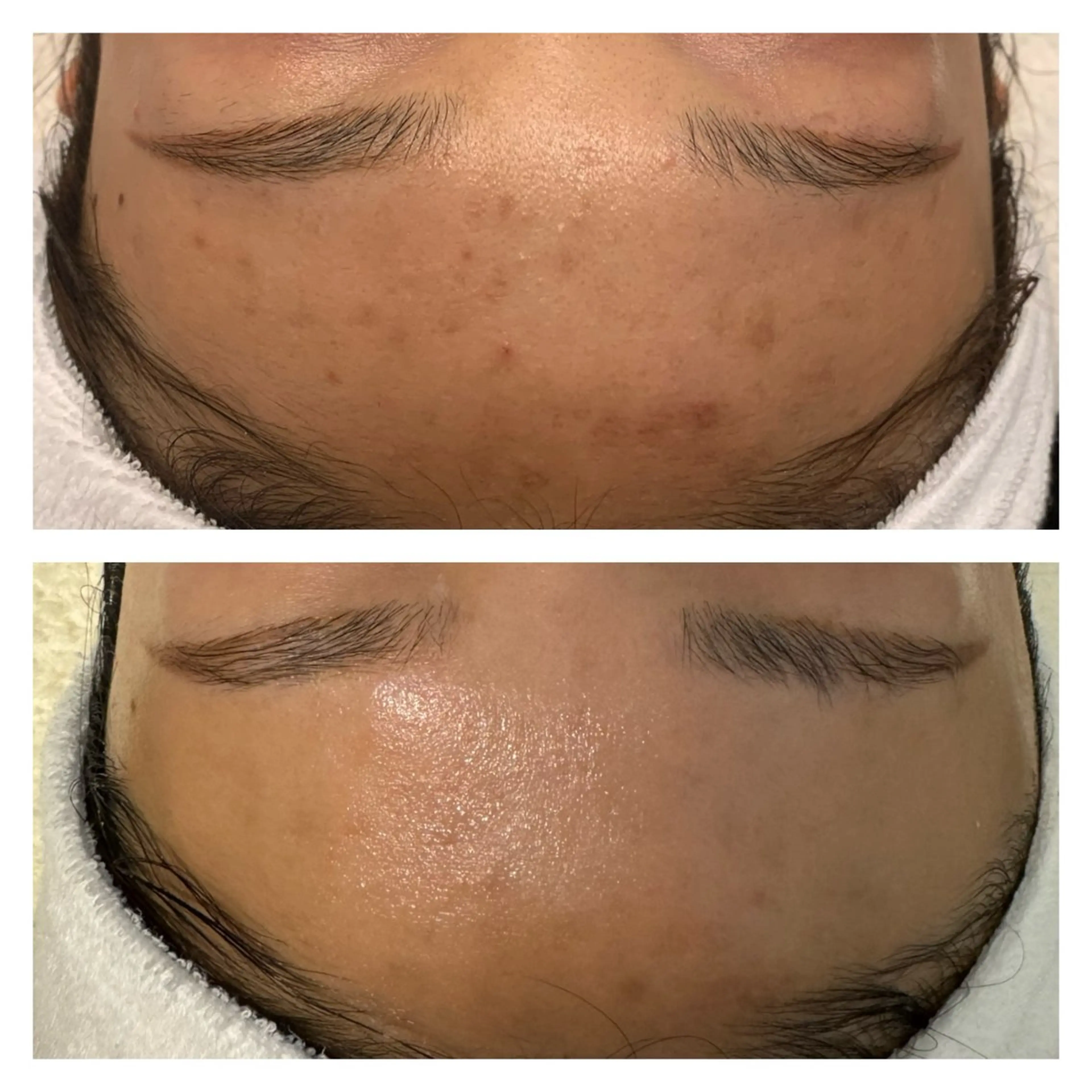 肌質改善/ツヤ肌作り /松本杏奈のエステ・リラクイメージ