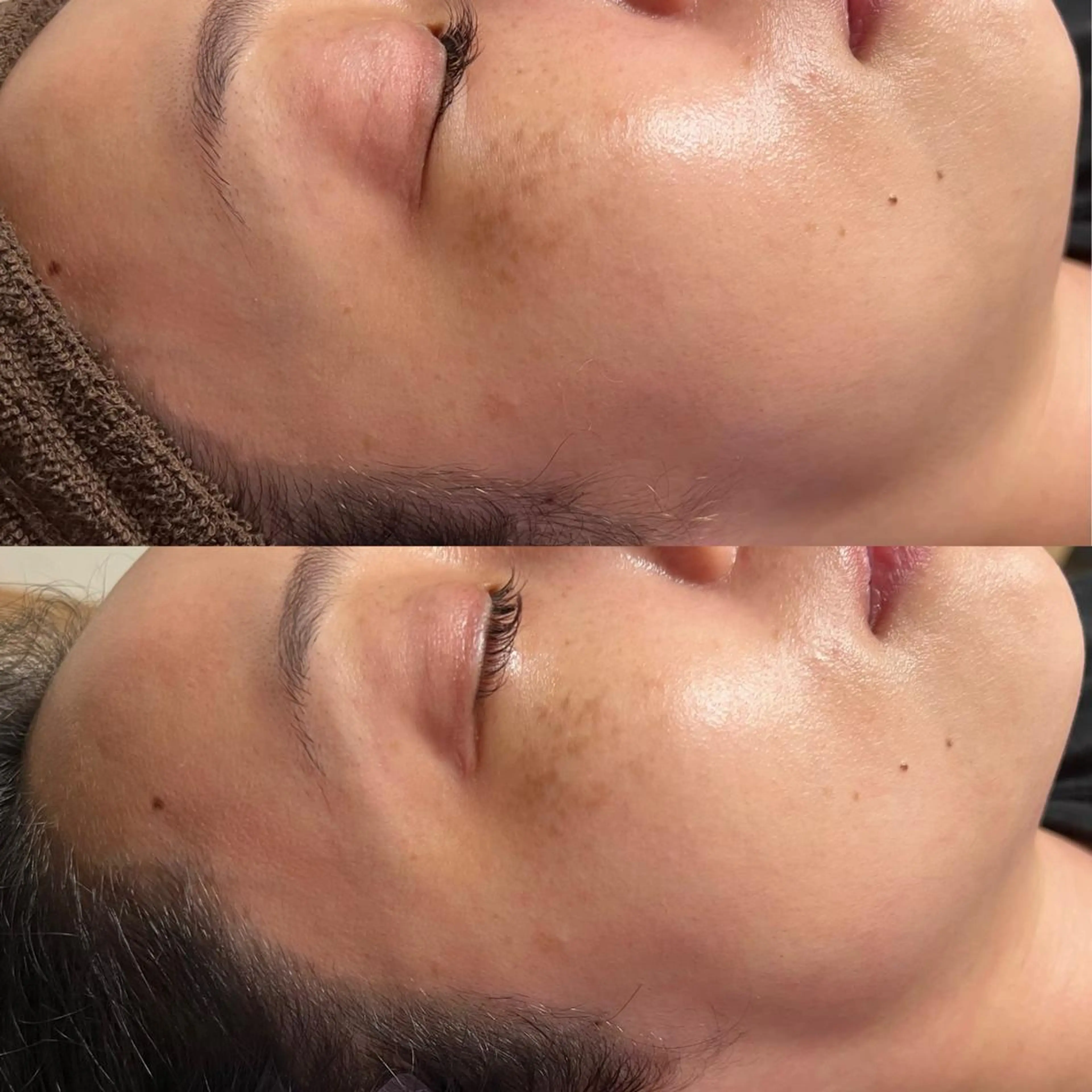 Epina 千葉店 【エピナ】のエステ・リラクイメージ