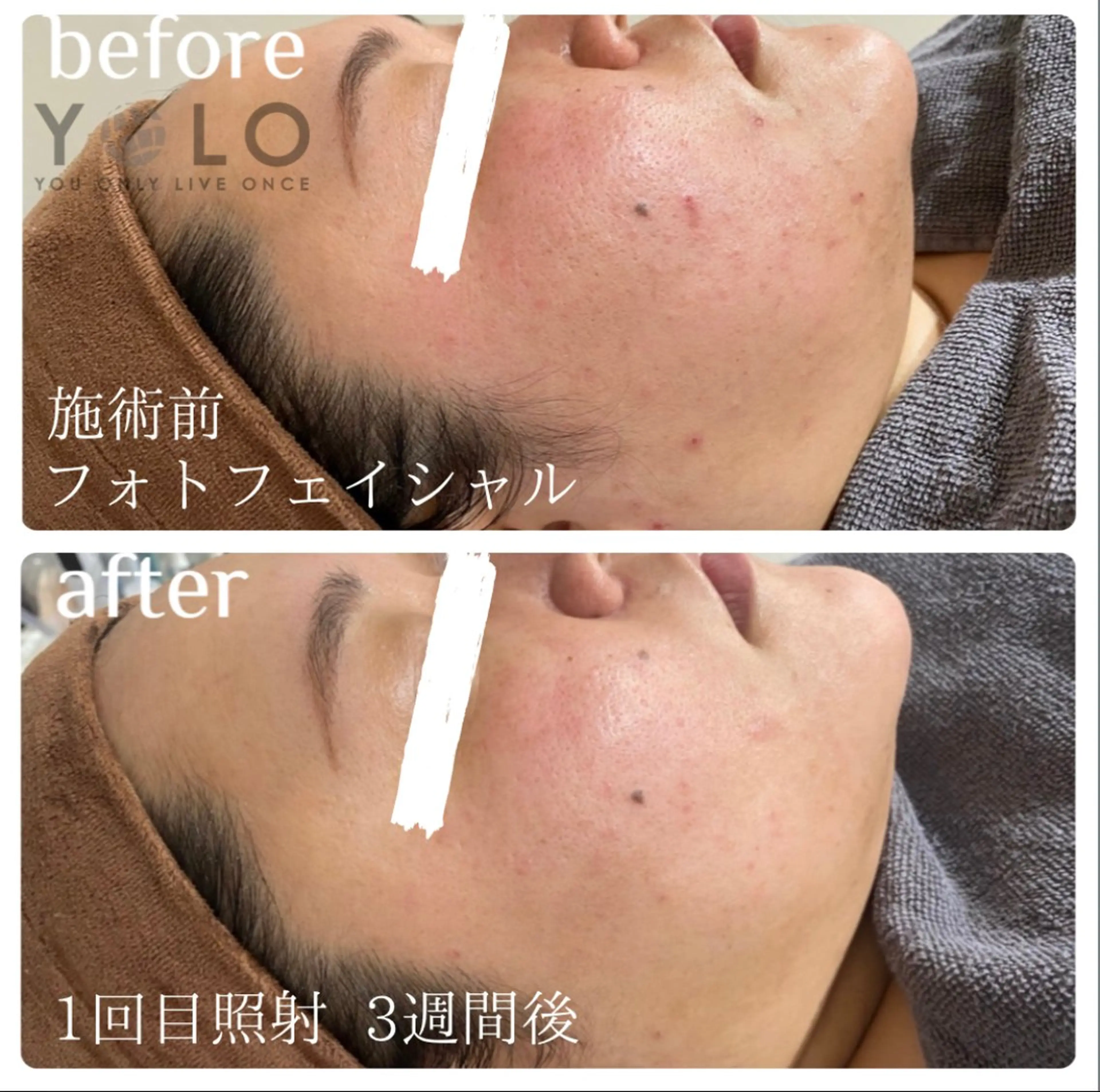 エステ YOLO 梅郷店所属・YOLO痩身/脱毛 🌼MARI🌼のエステ・リラクイメージ