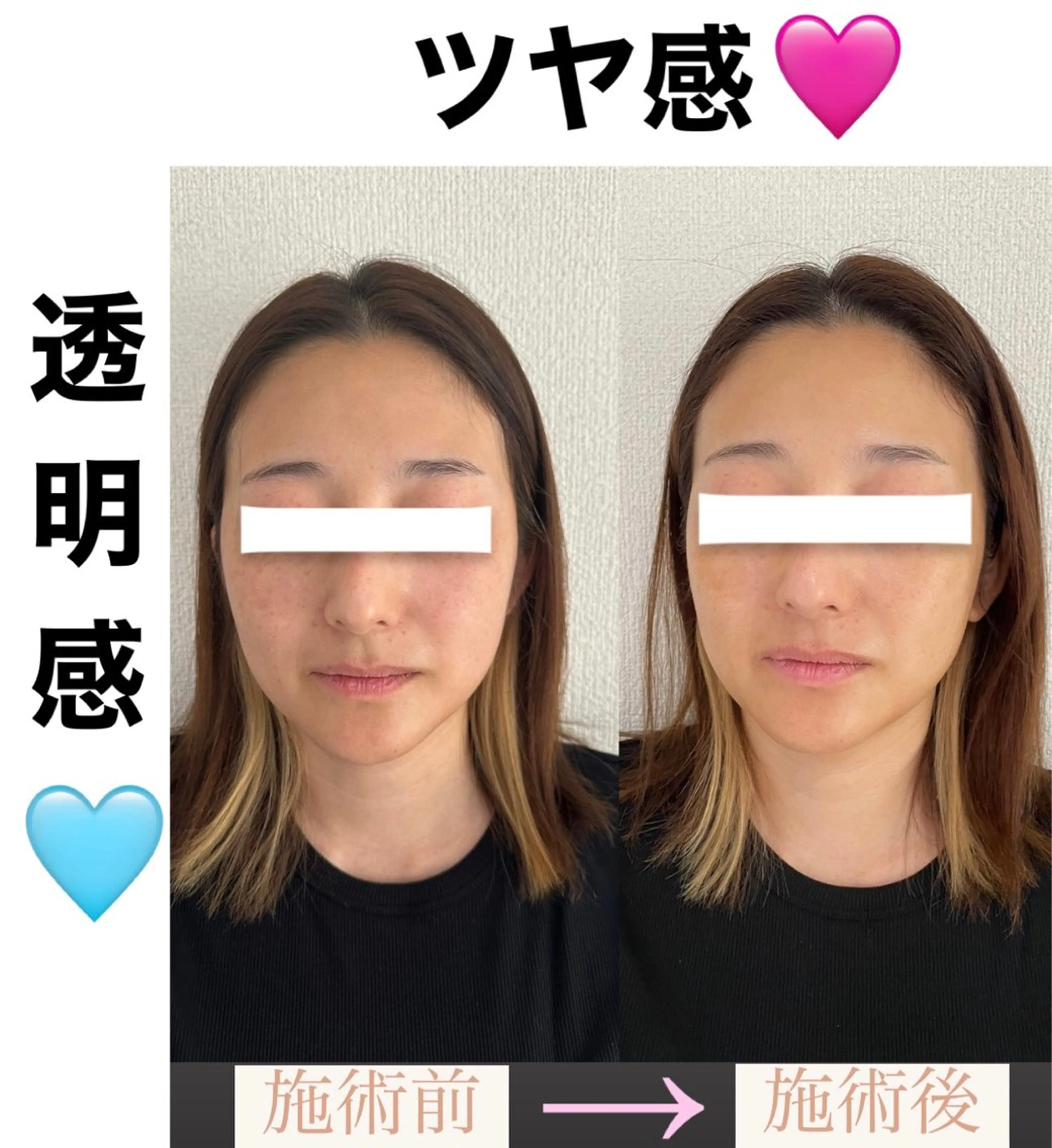 脱毛&美容サロン BLUESEAのエステ・リラクイメージ