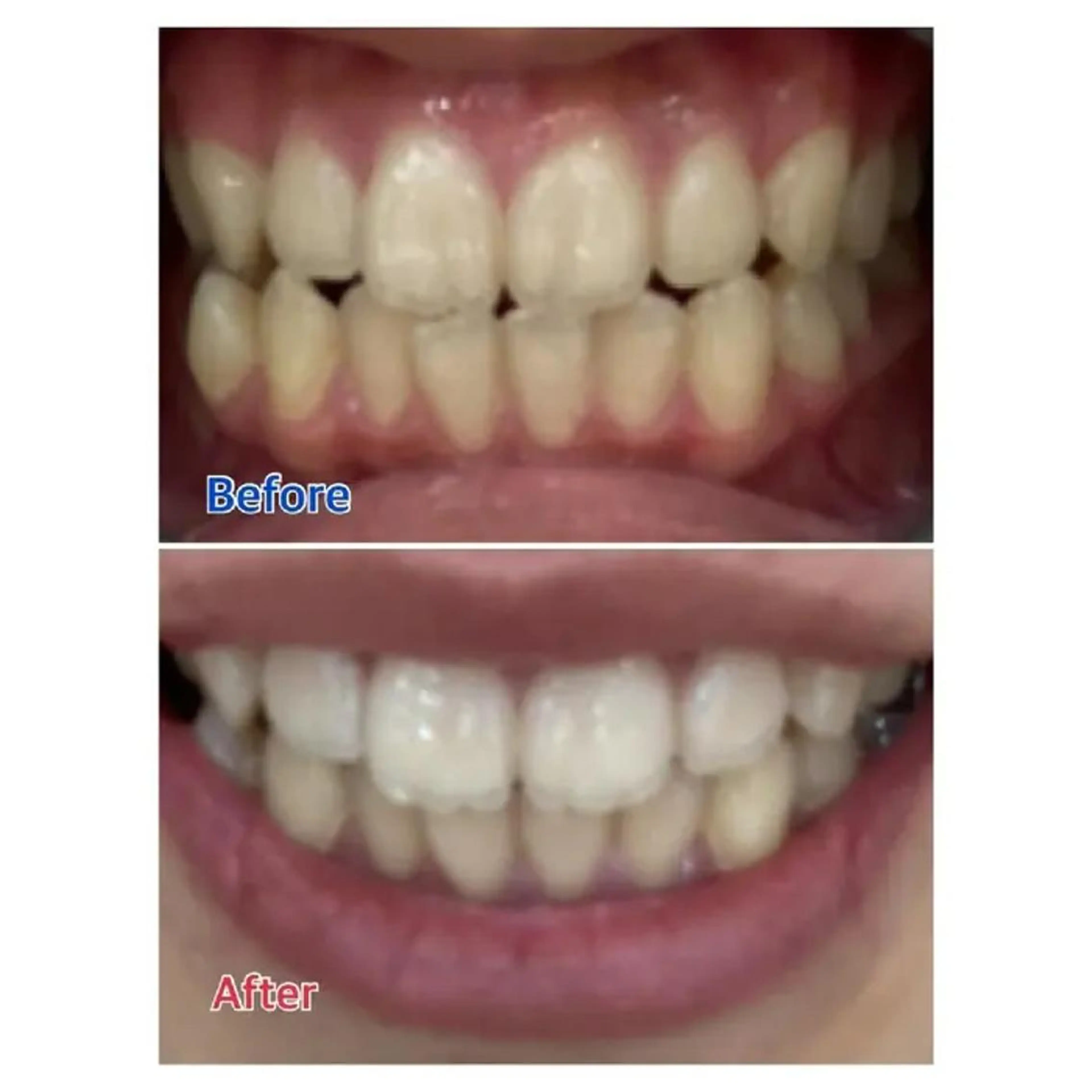 M渋谷 ホワイトニングのその他イメージ