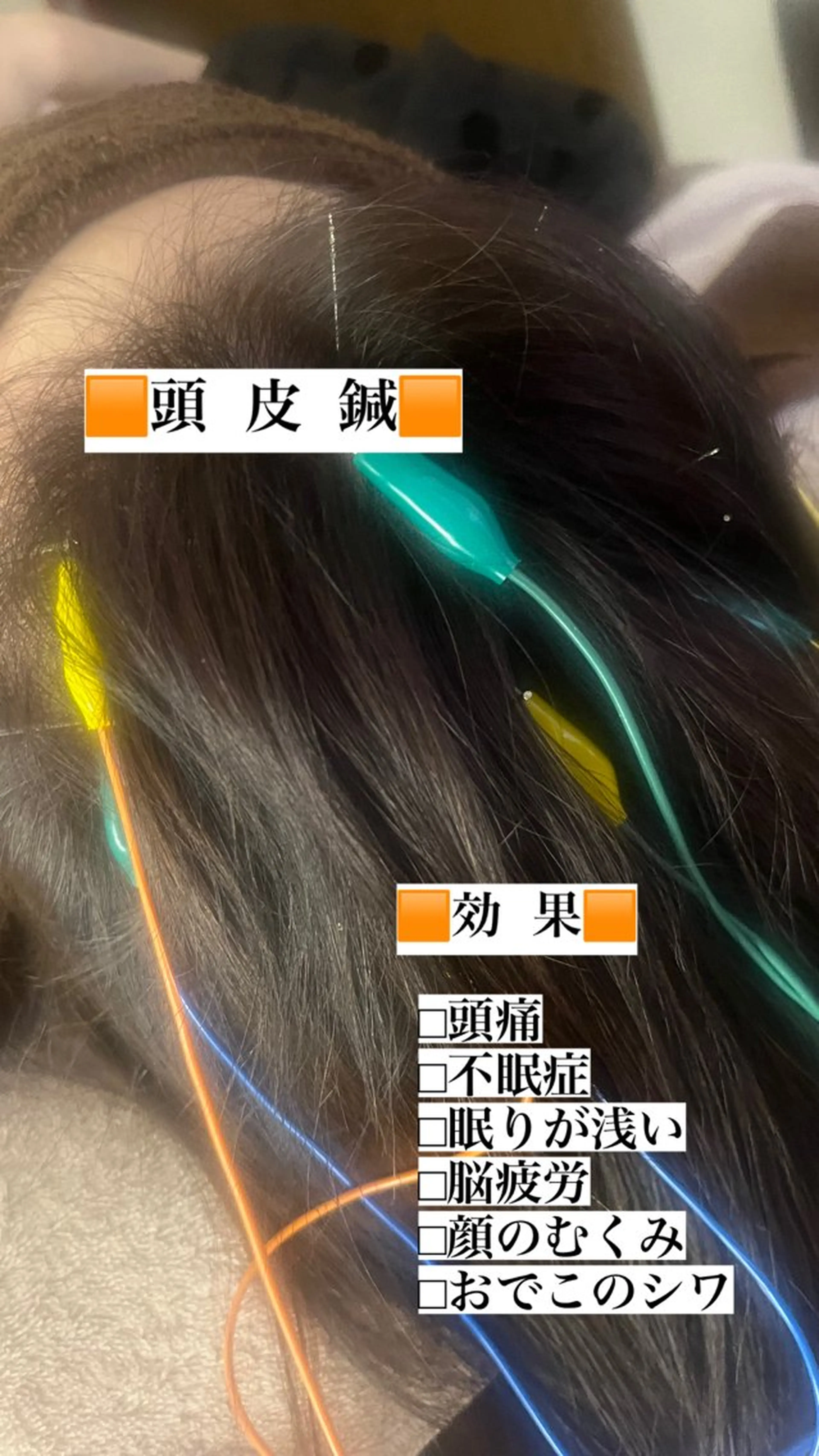 その他 アロマ･美容鍼･カッ ピング「麗」鍼灸院のエステ・リラクイメージ