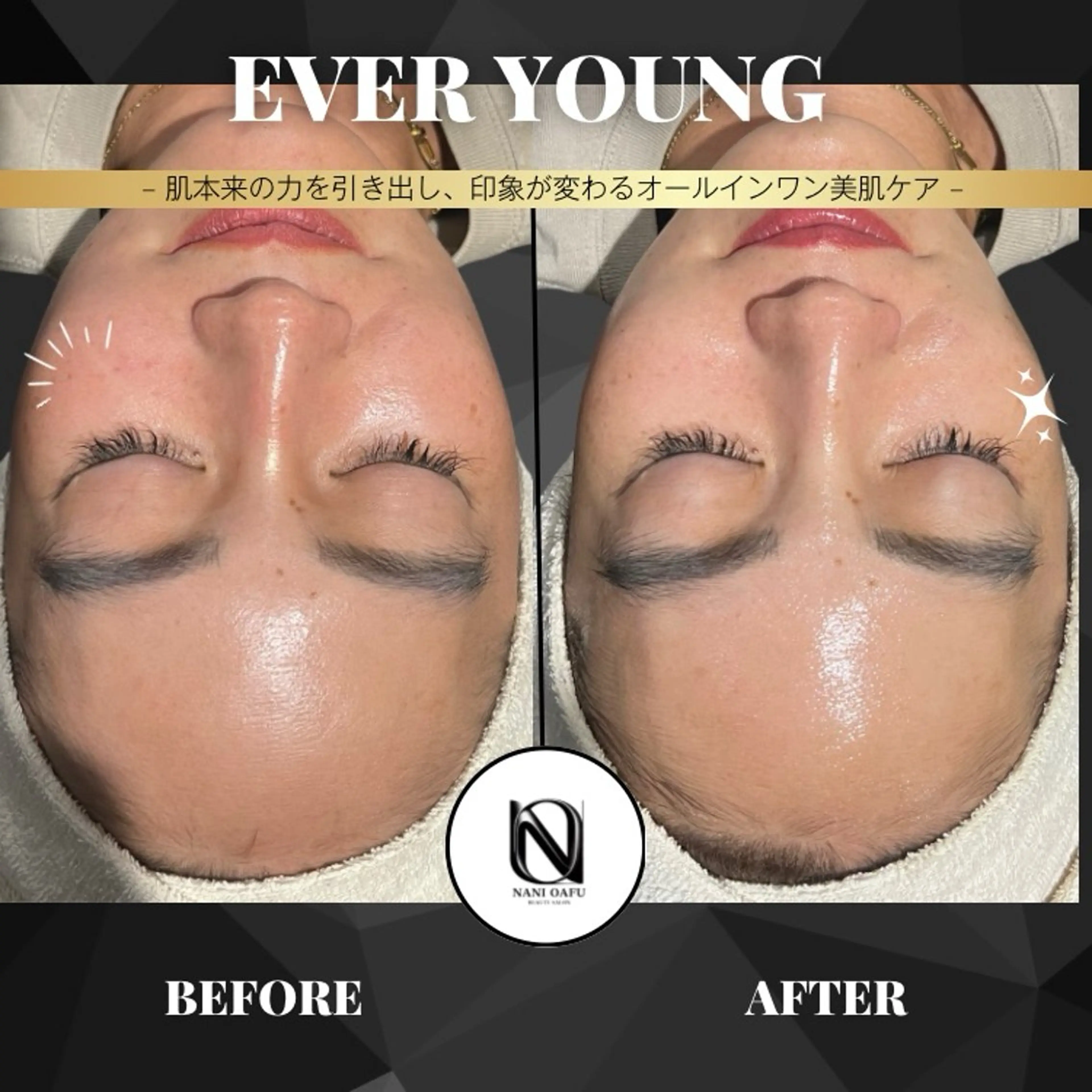 【✨1回で肌印象UP】EVER YOUNG｜うるおい・ハリ・毛穴ケアをまとめてサポート〈メンズOK〉の写真